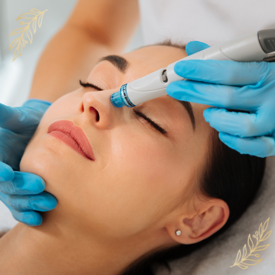 Microneedling in Guildford