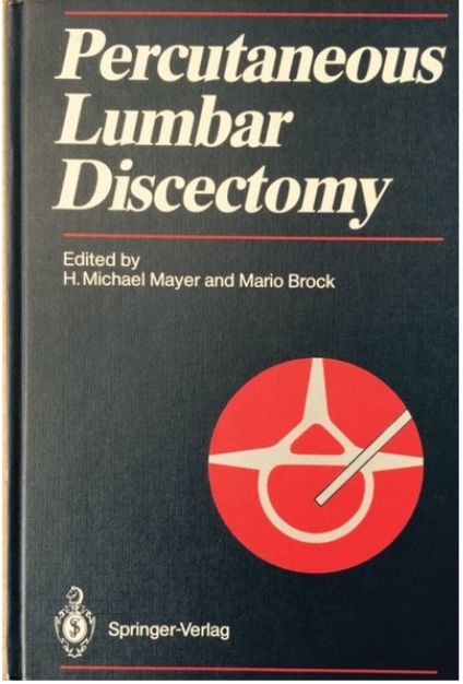 percutanious lumbar discectomy 1989.jpg
