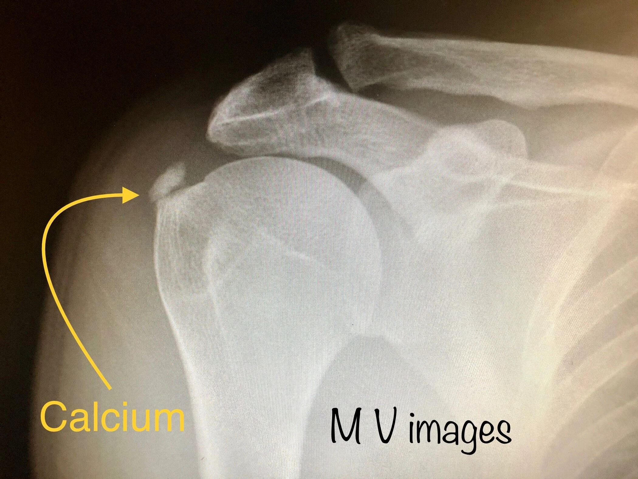 calcium.jpeg