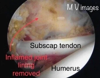 scope FS2.jpeg