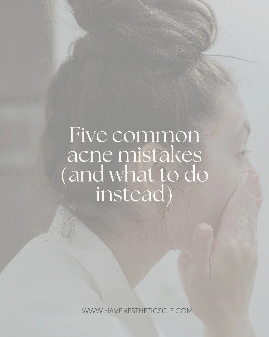 Sometimes it&rsquo;s the little habits that keep acne hanging around. Here are 5 common mistakes we see all the time, and what to do instead. 💕 

Your skin deserves gentle, consistent care!