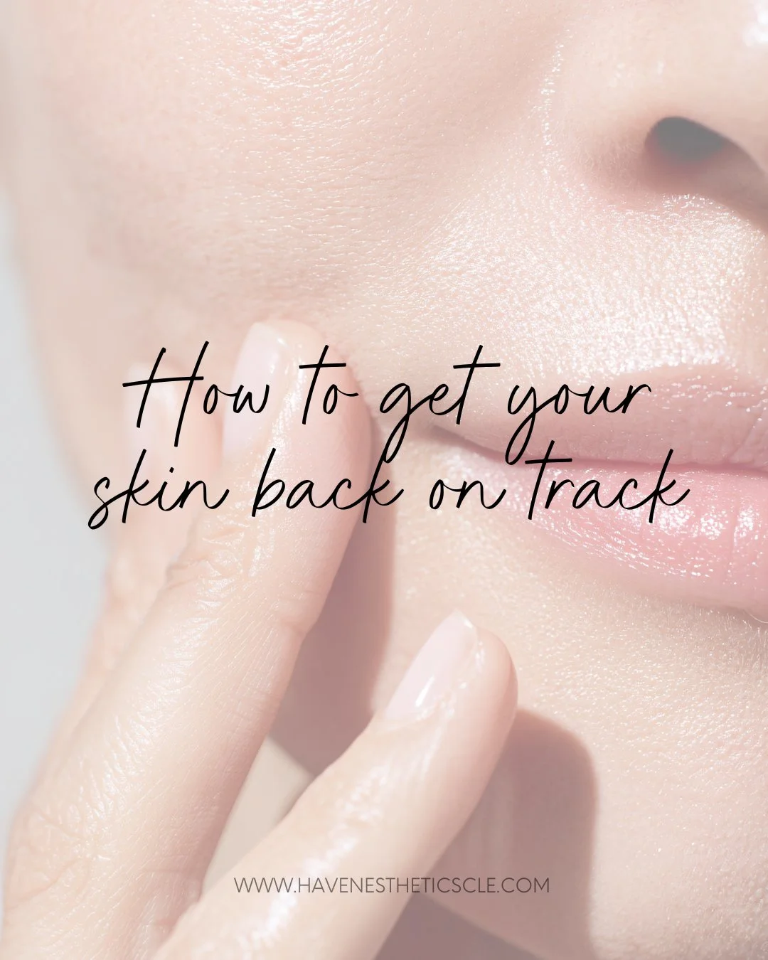 Here&rsquo;s a calm, polished caption you can use:

The holidays are full of fun, family, and&hellip; a little chaos for our skin. If you&rsquo;re feeling more congested, dry, or uneven than usual, you&rsquo;re not alone. A busy season can throw even