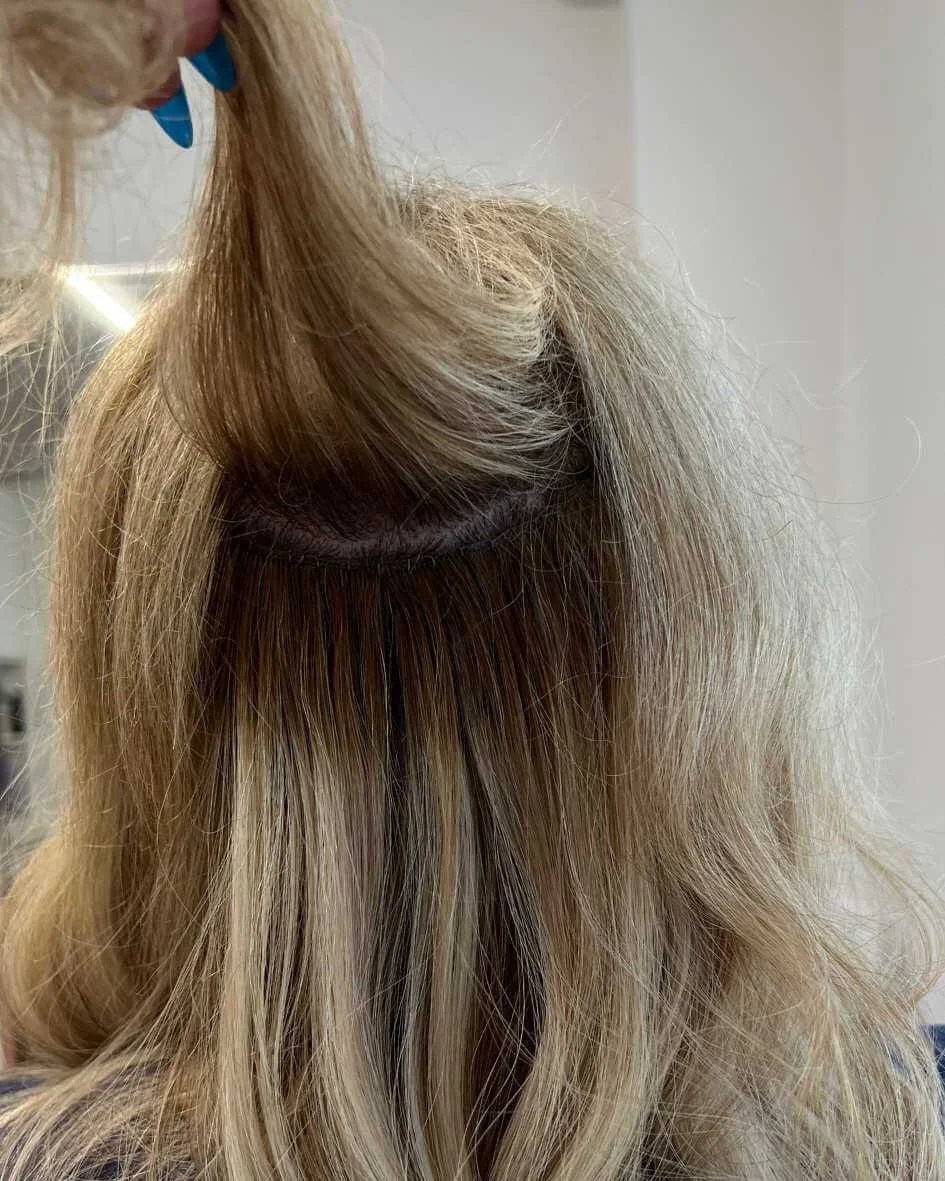 Hair Loss on Ozempic: What No One Told You (and How to Recover)