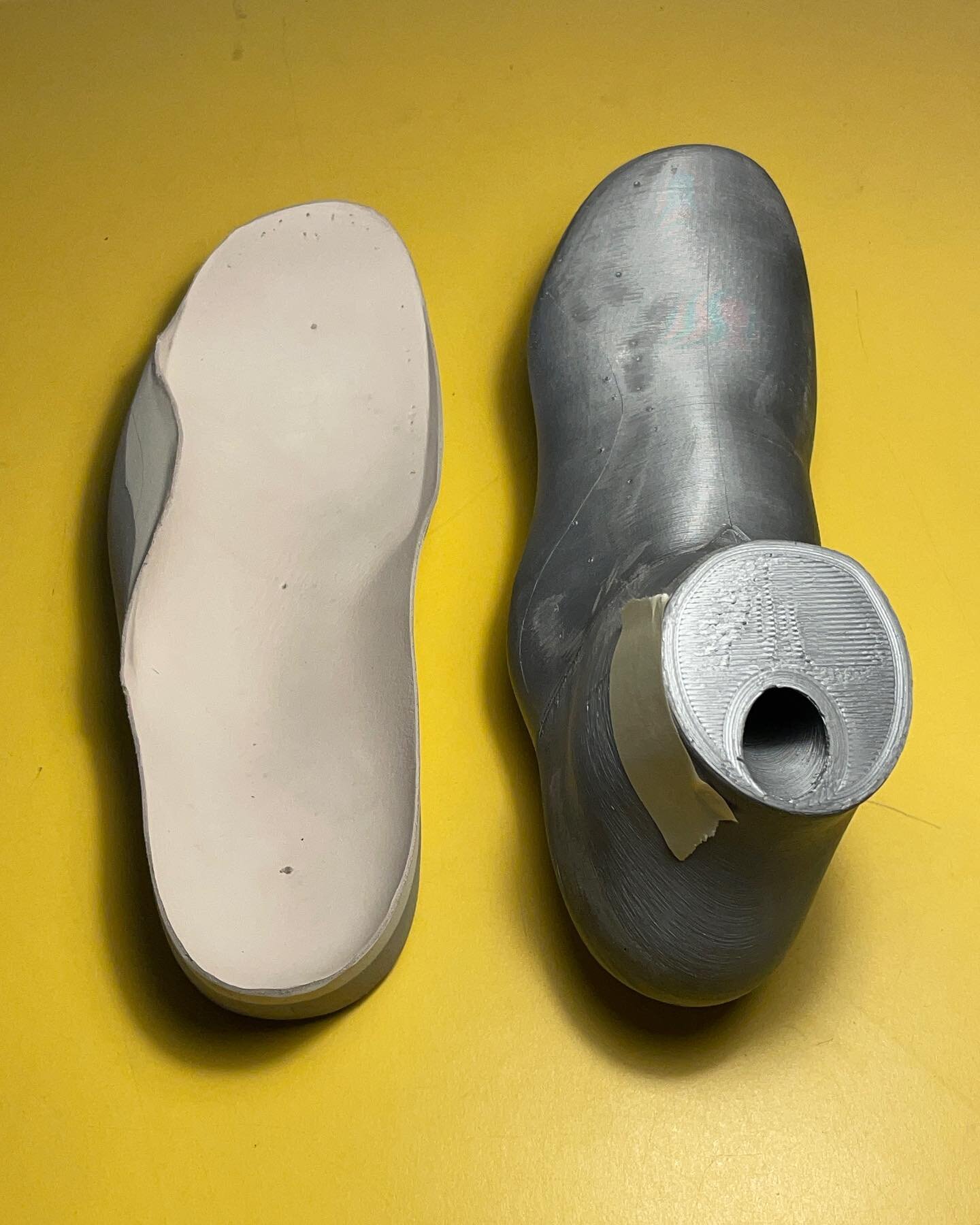 A rocker-bottom foot is managed well with custom footwear that accommodates and guides the unique shape to distribute pressure. Fillers are added to the insole to increase lateral support and coincidentally make for a normal looking boot.