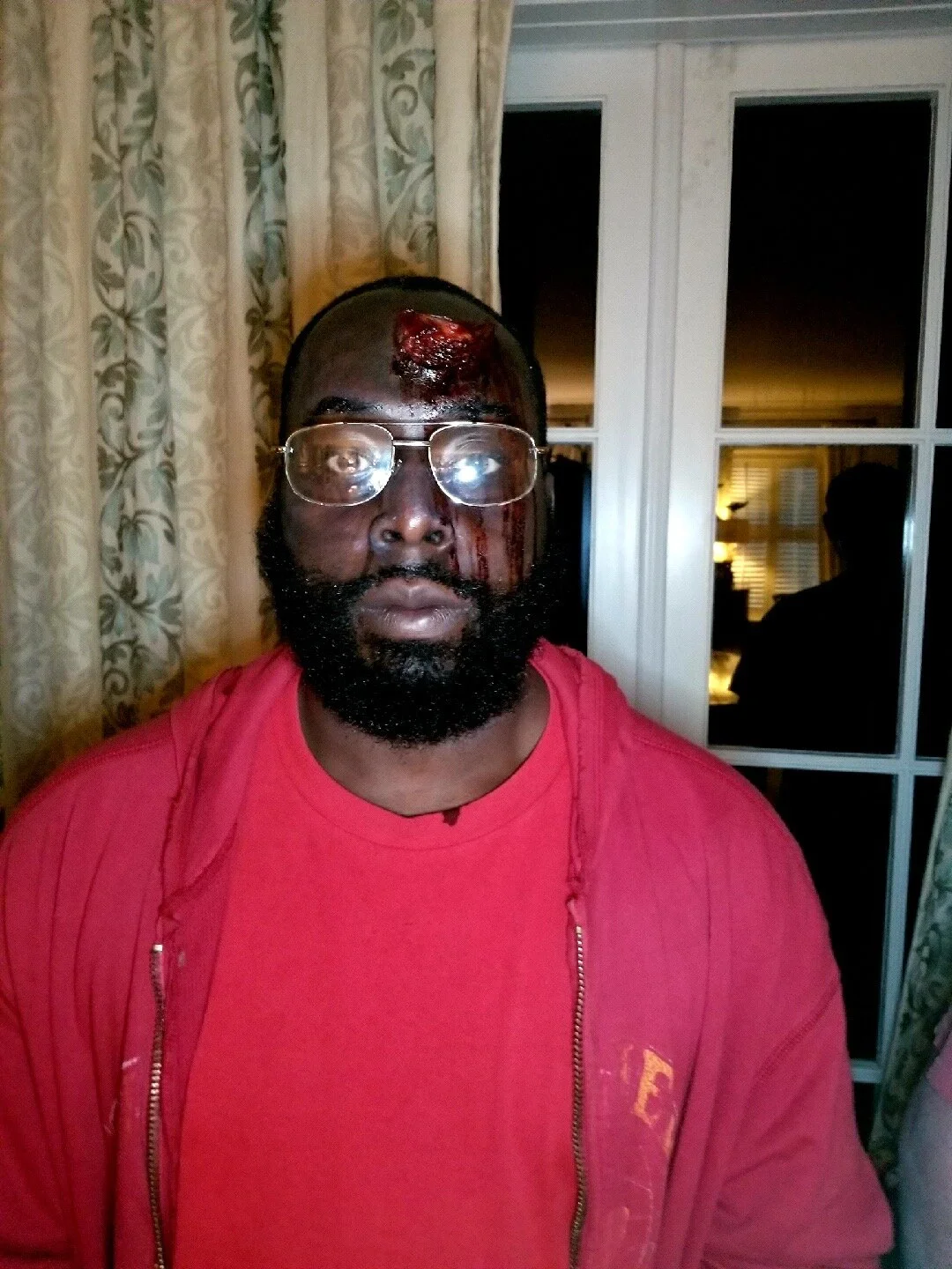 Gunshot wound