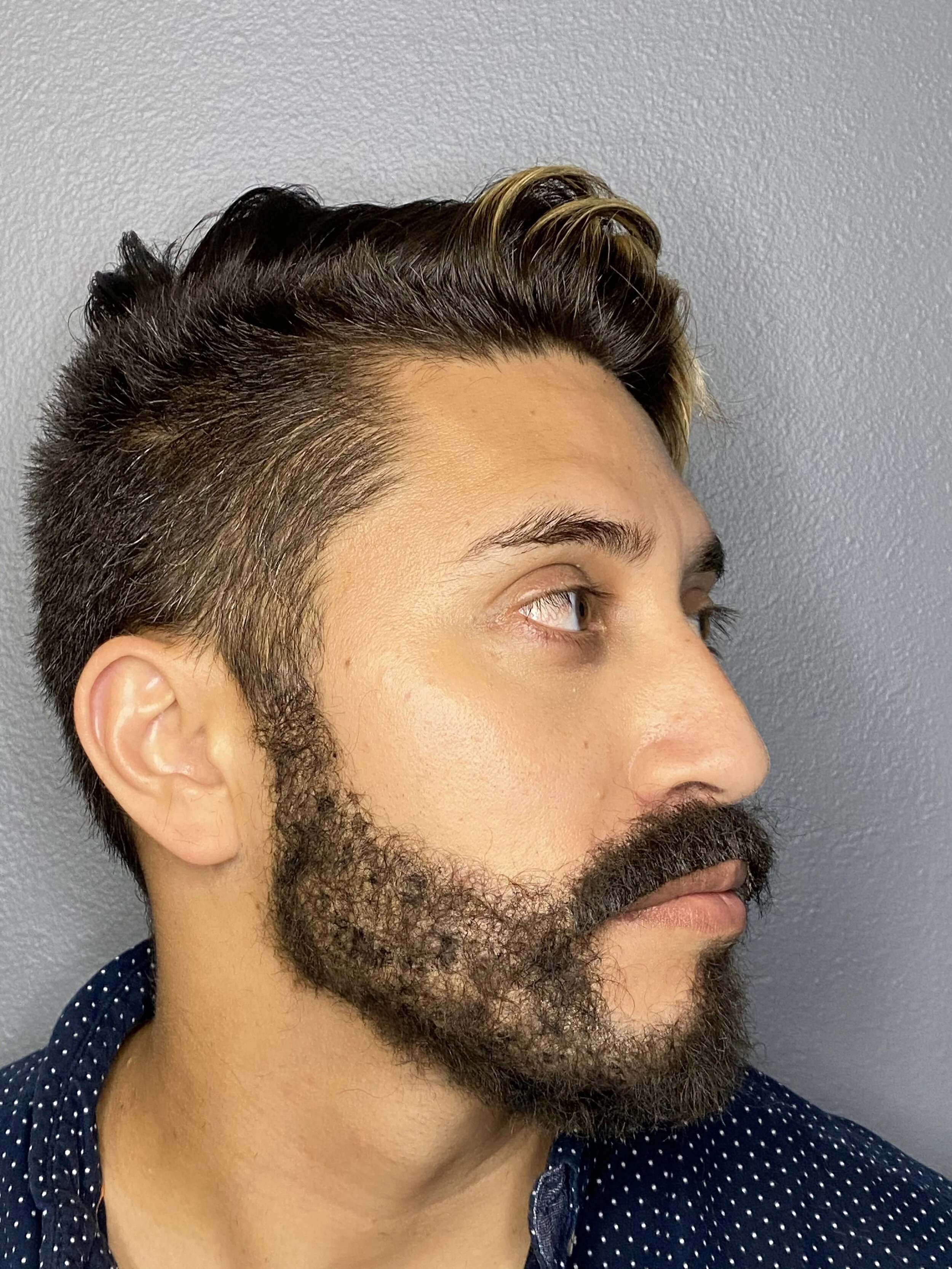 Beard Lay + Lace Moustache