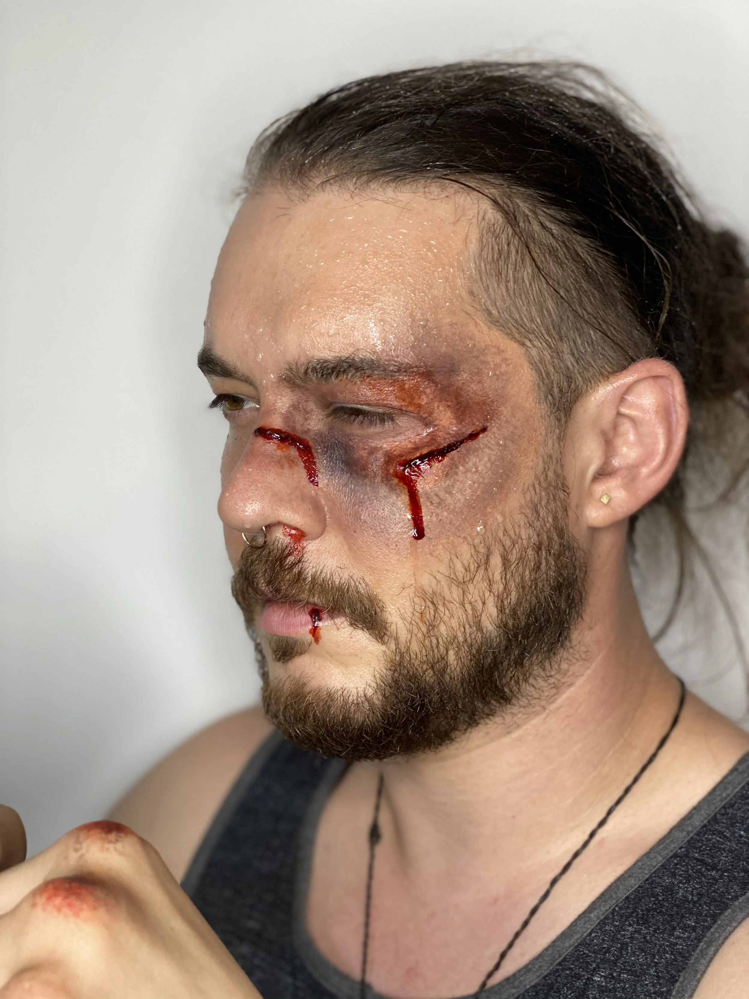 Bruising + Swollen Eye Prosthetic + Sweat