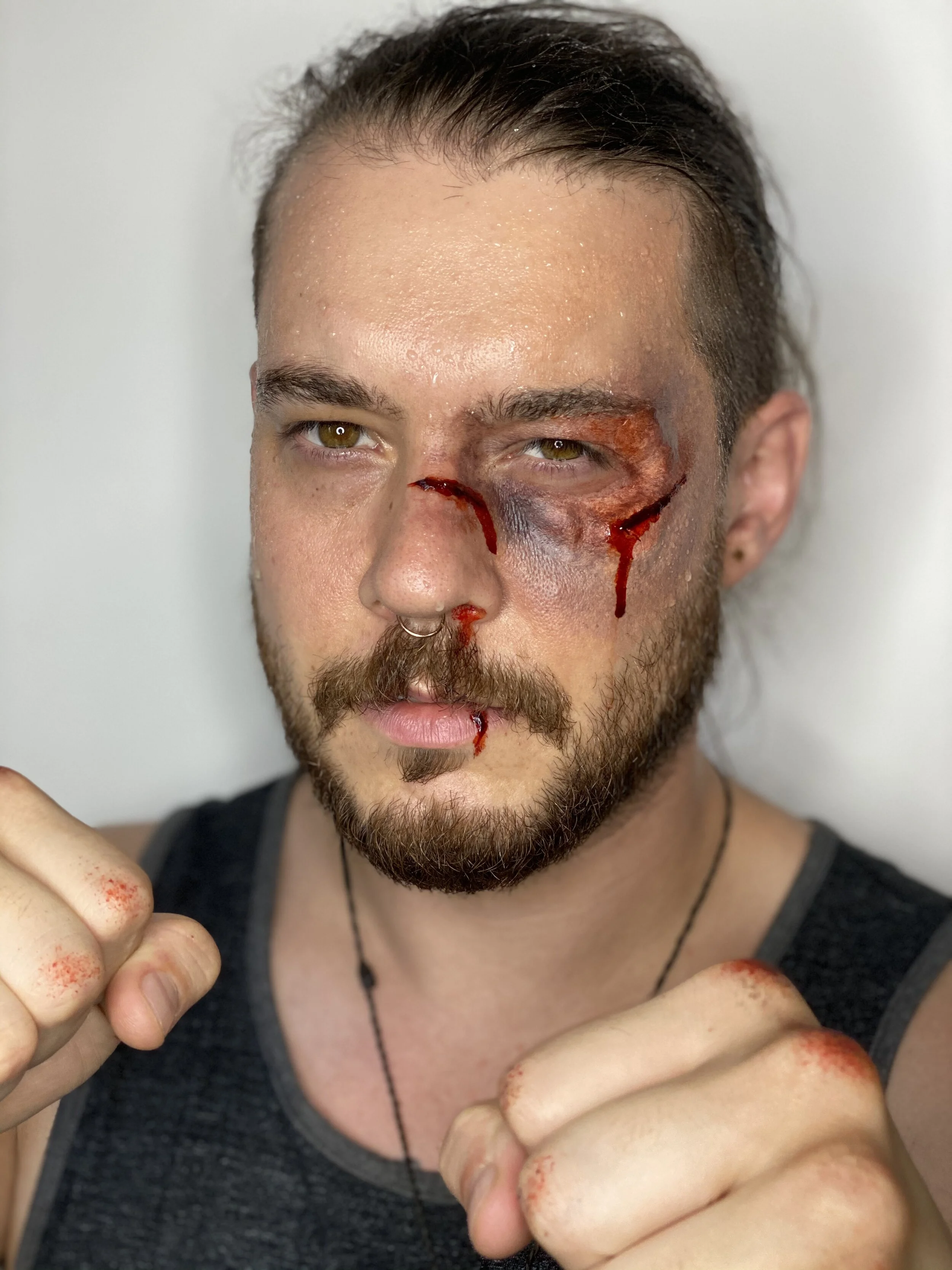 Bruising + Swollen Eye Prosthetic + Sweat