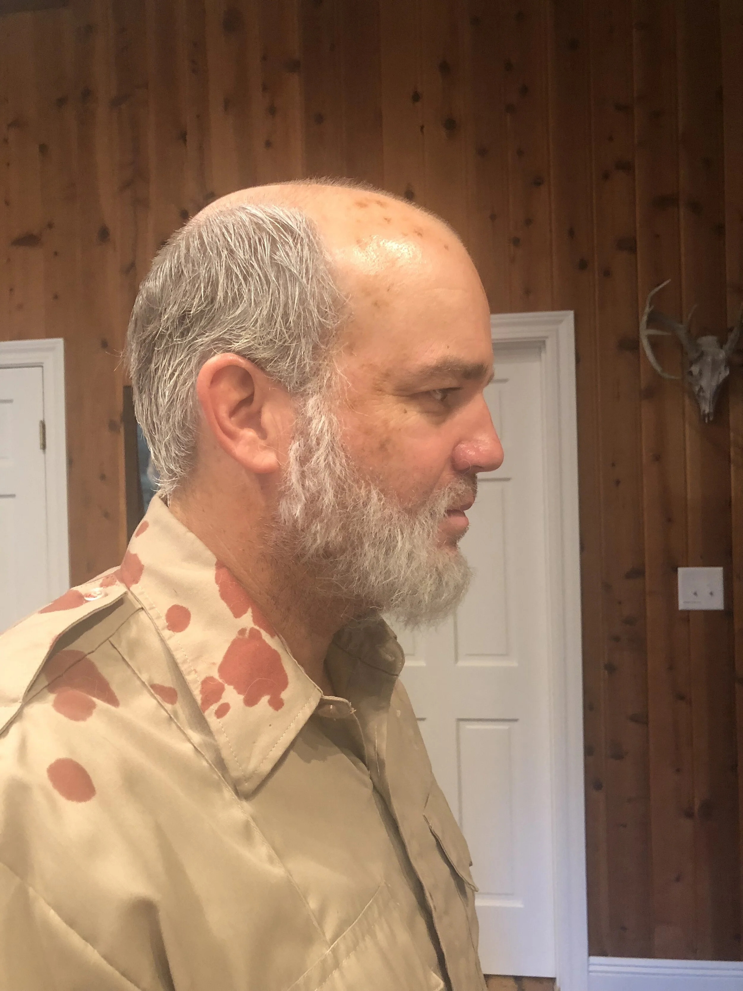 Age Spots 