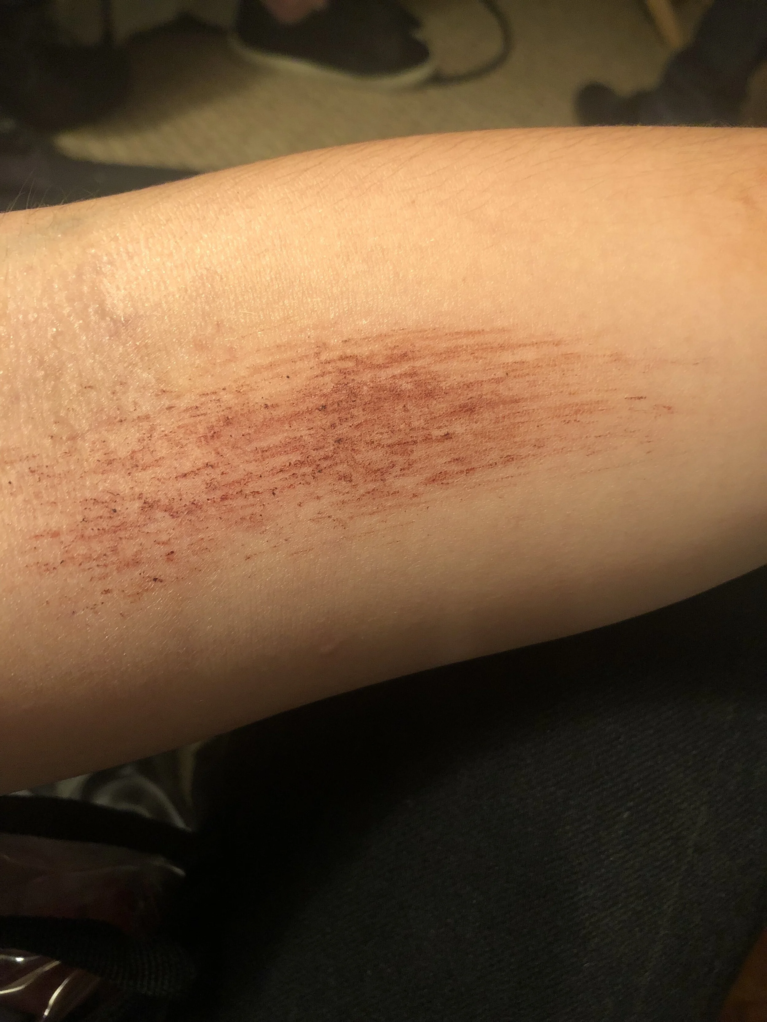 Scrape