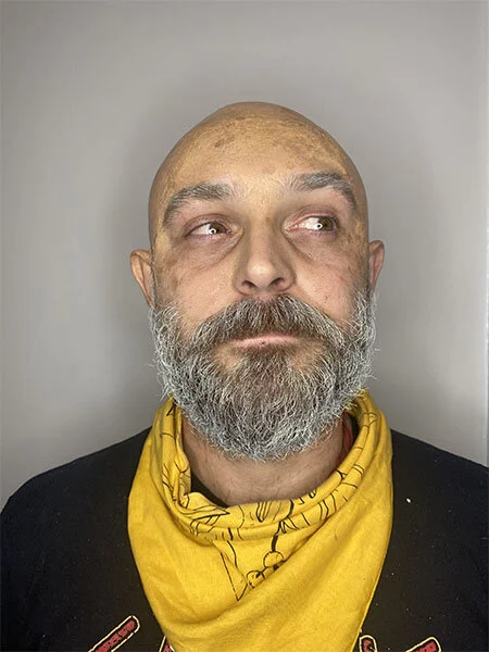 Bald Cap