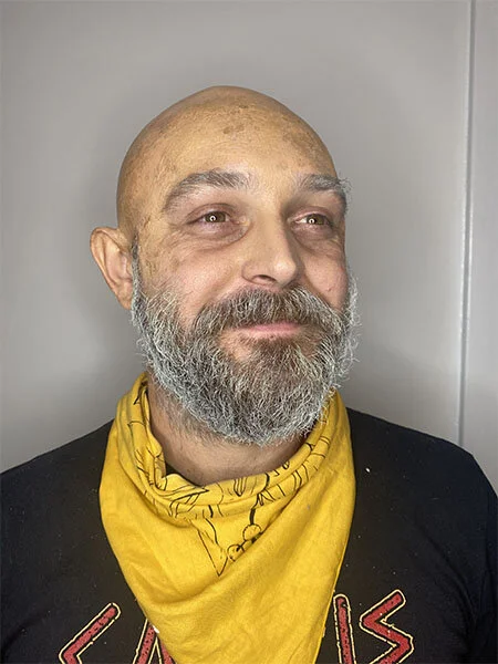 Bald Cap