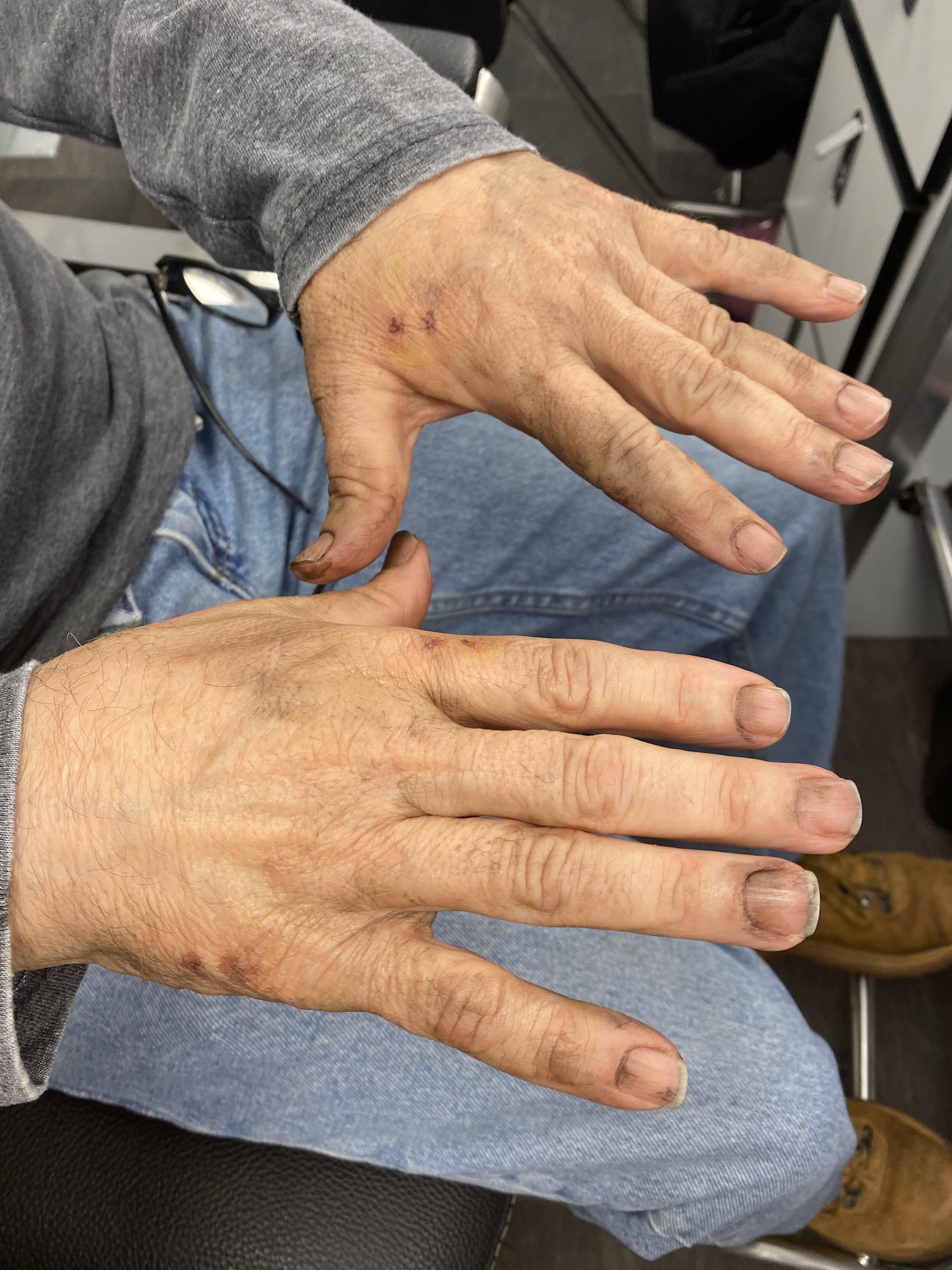 Worn Hands + Old Reptile Bites