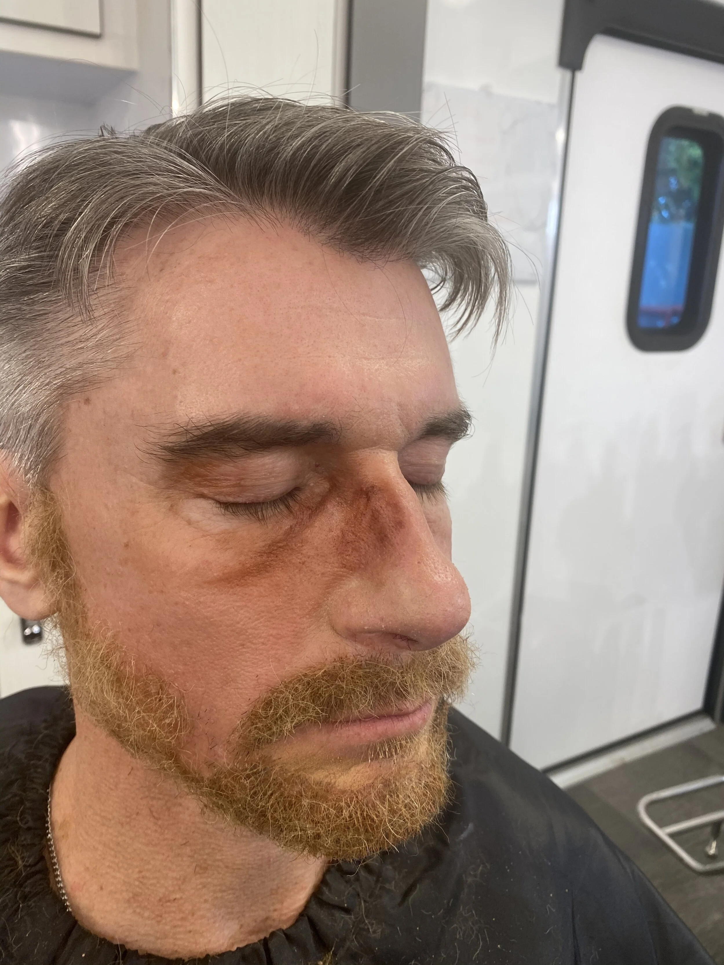 Black Eye