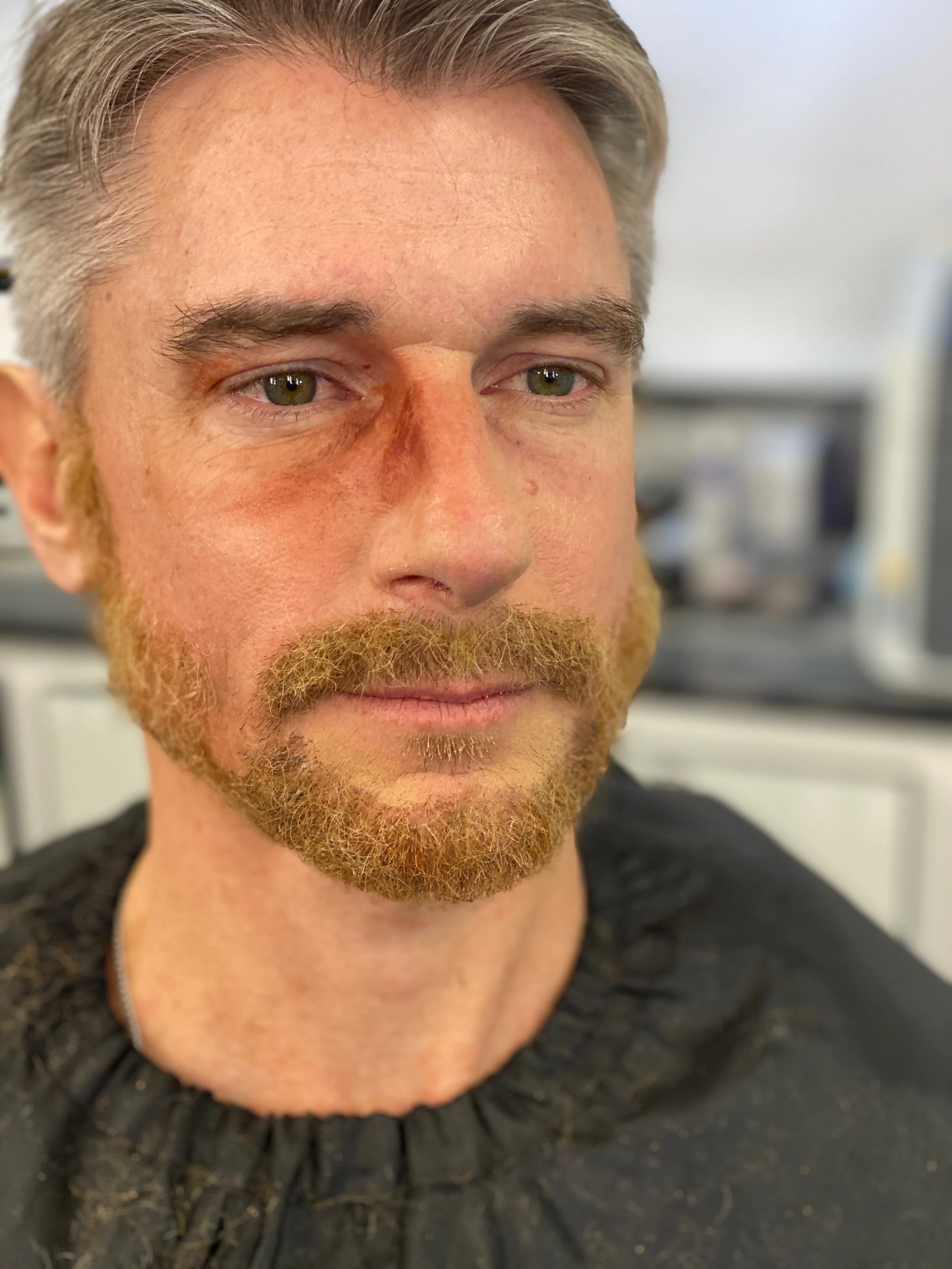 Black Eye