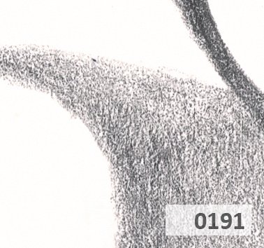 Slice 191.jpg