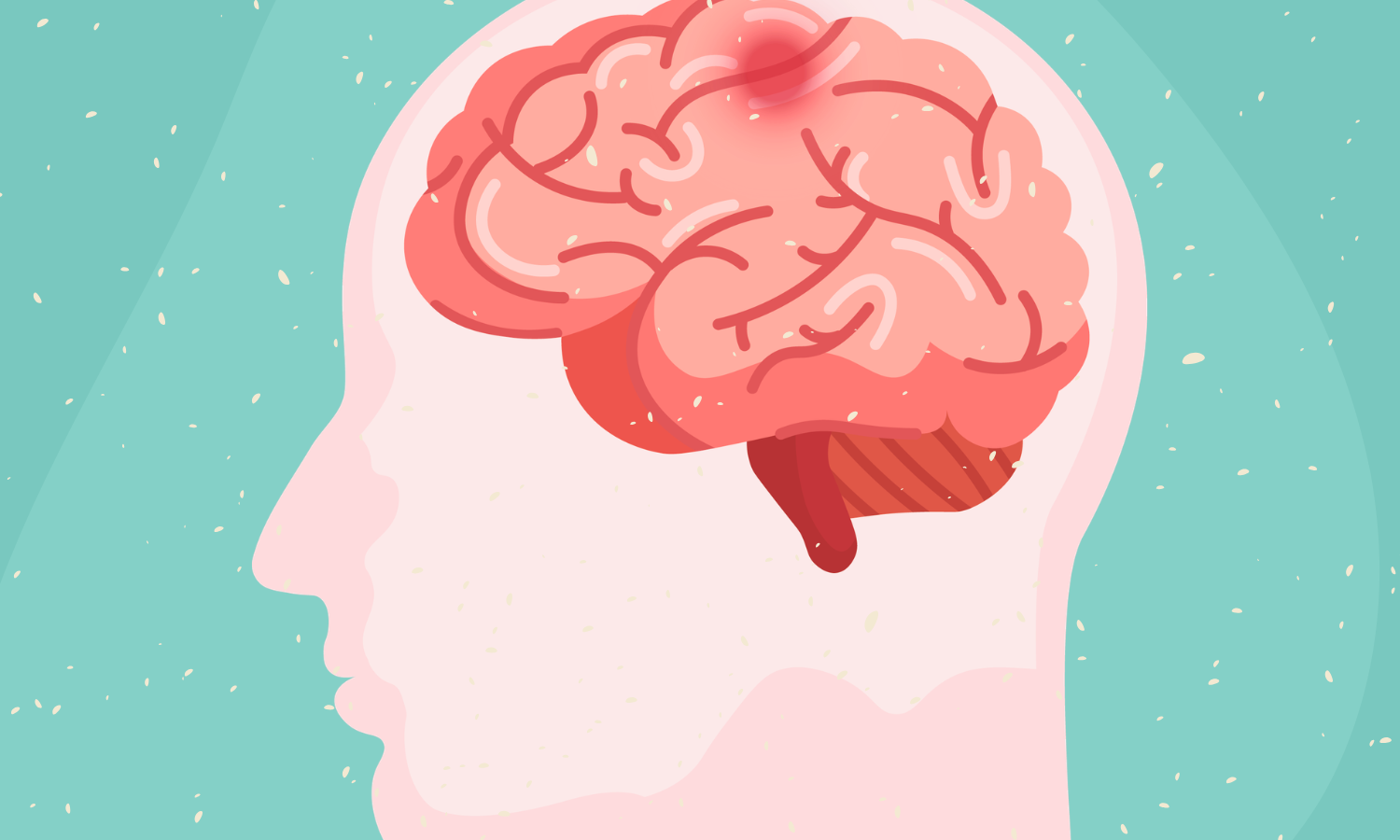 Not all trauma policies are created equal