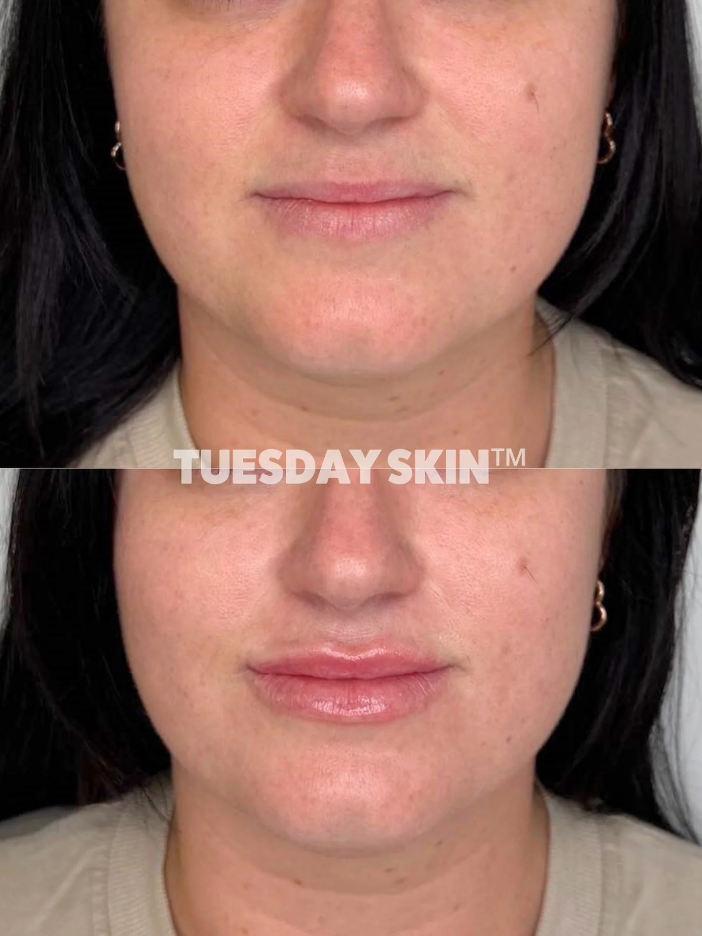 OF course...Been awhile since I&rsquo;ve posted some good ol lips 🫦