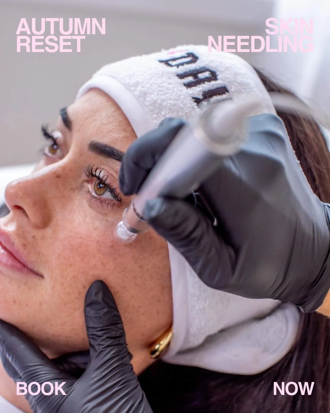 Autumn is the perfect time to reset your skin. Book skin needling for your face and neck and you&rsquo;ll get your d&eacute;colletage + LED upgrade + SIMKA sheet mask on us 😘

Don&rsquo;t sleep on it - available in Kerikeri and Whangarei until the e