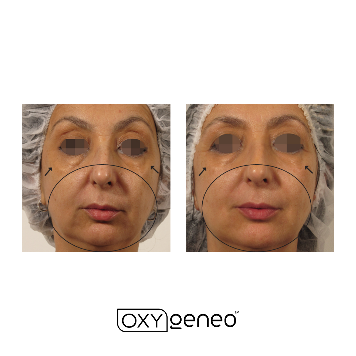 Want tighter skin? — Esstudio Galleria