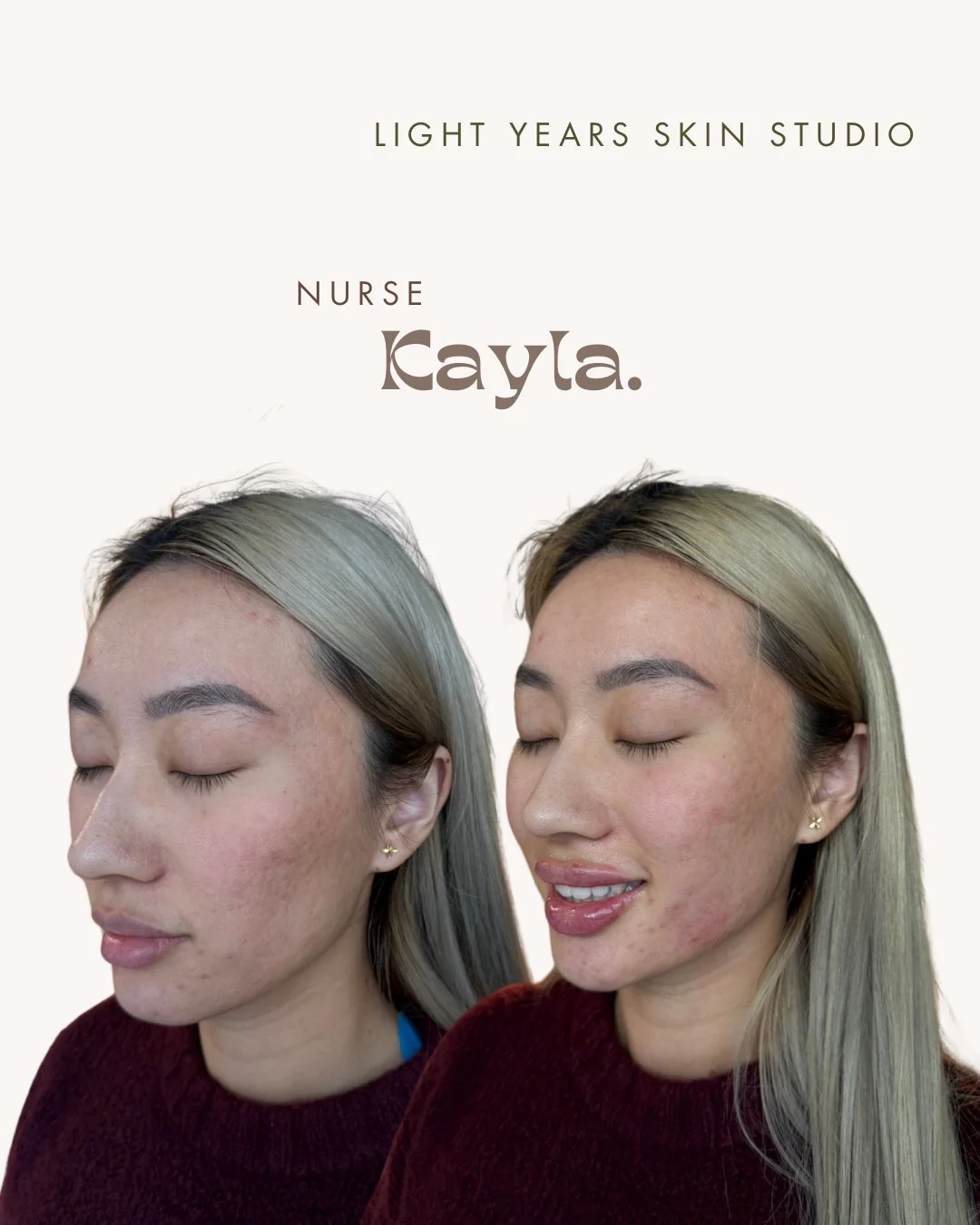B&A LIPS - 5.jpeg