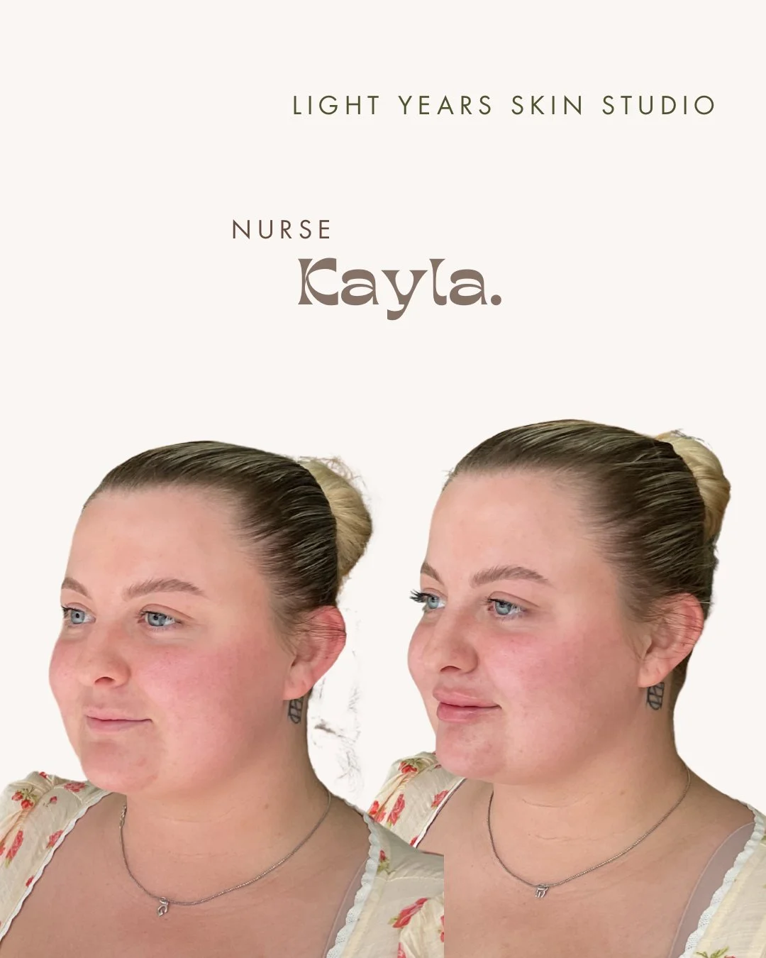B&A LIPS - 2.jpeg