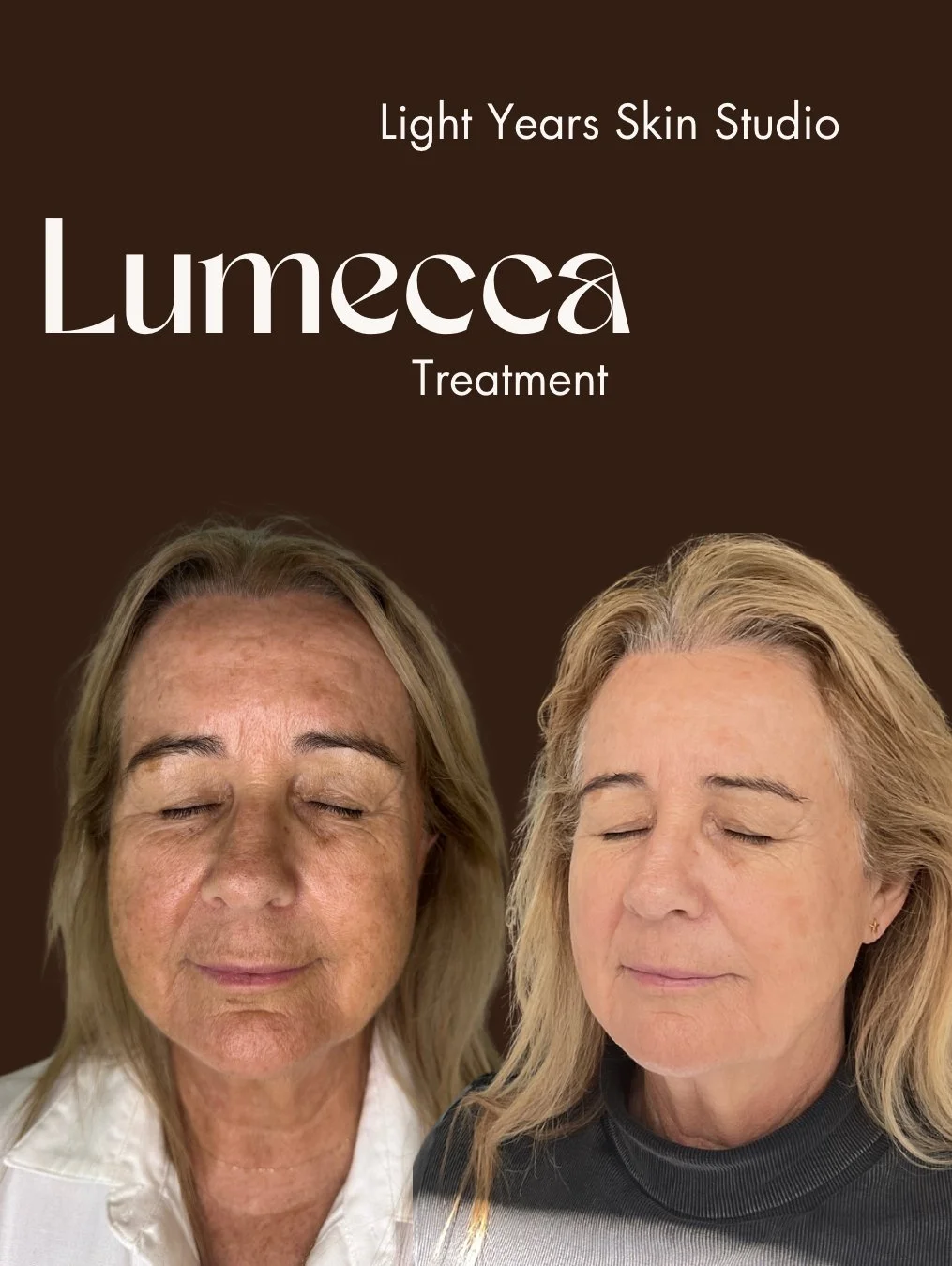 Lumecca - 32.jpeg