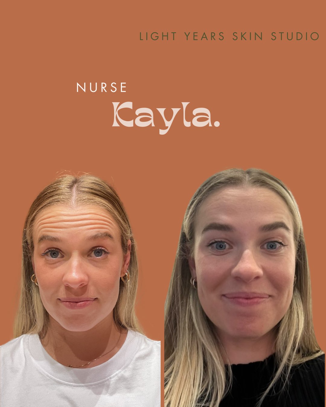 B&A Anti-Wrinkle.png.jpeg