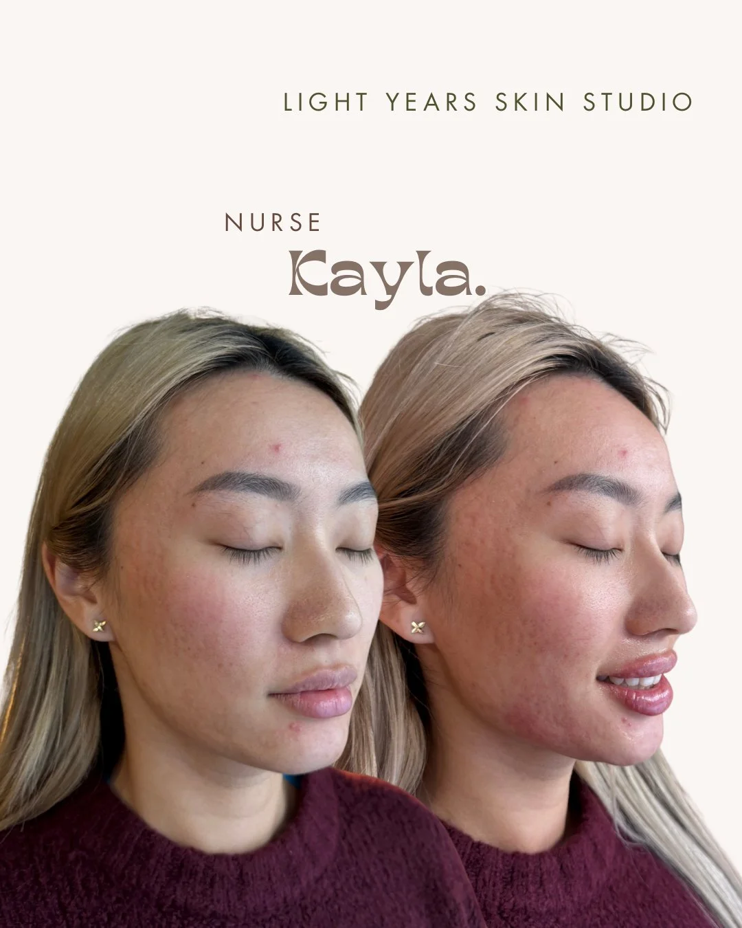 B&A LIPS - 4.jpeg