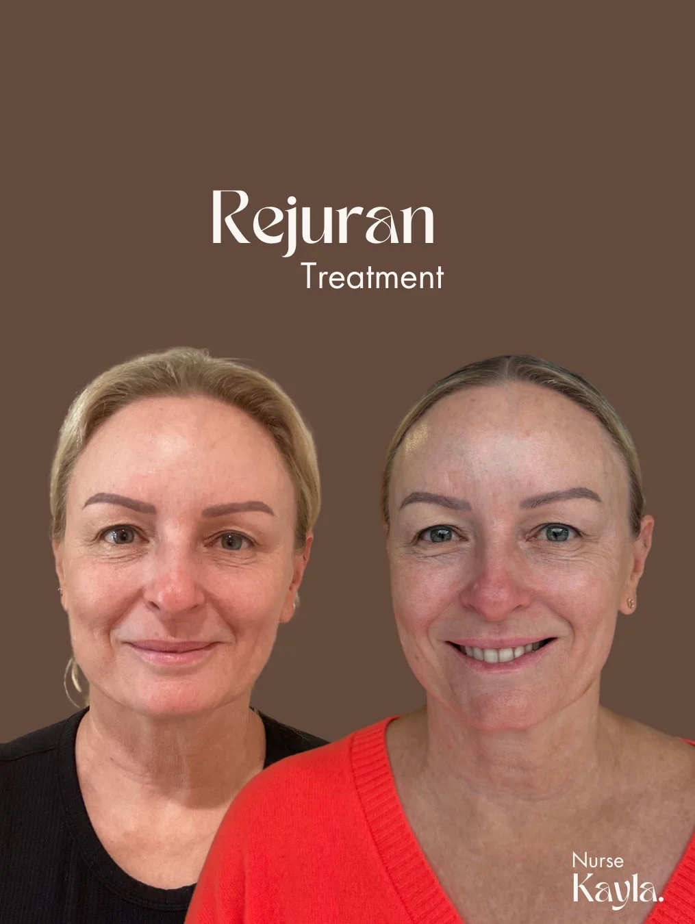 Rejuran (1015 x 1350 px) - 6.jpeg