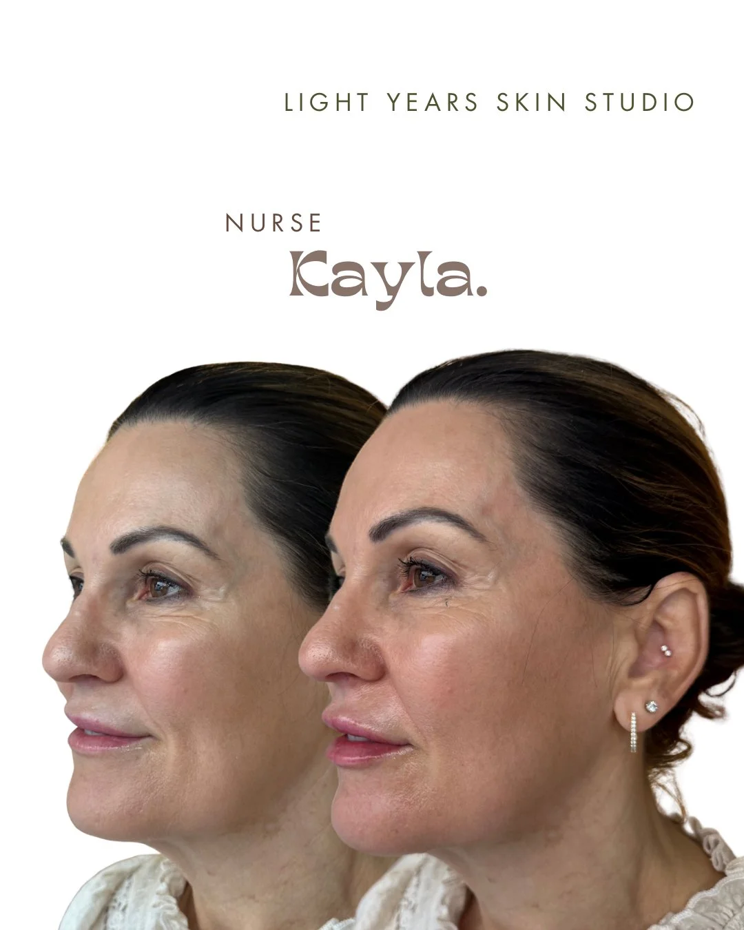 B&A LIPS - 6.jpeg