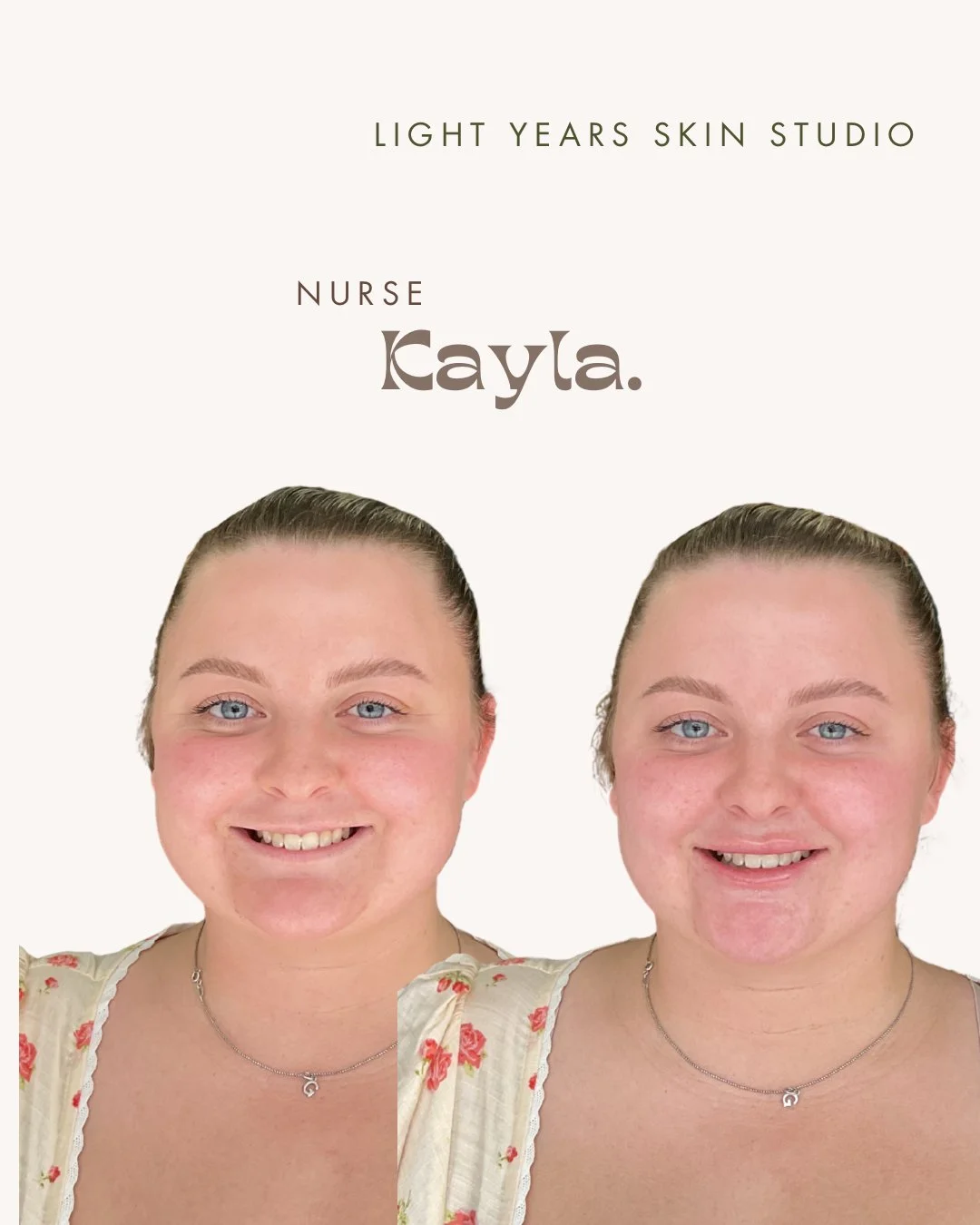B&A LIPS - 3.jpeg