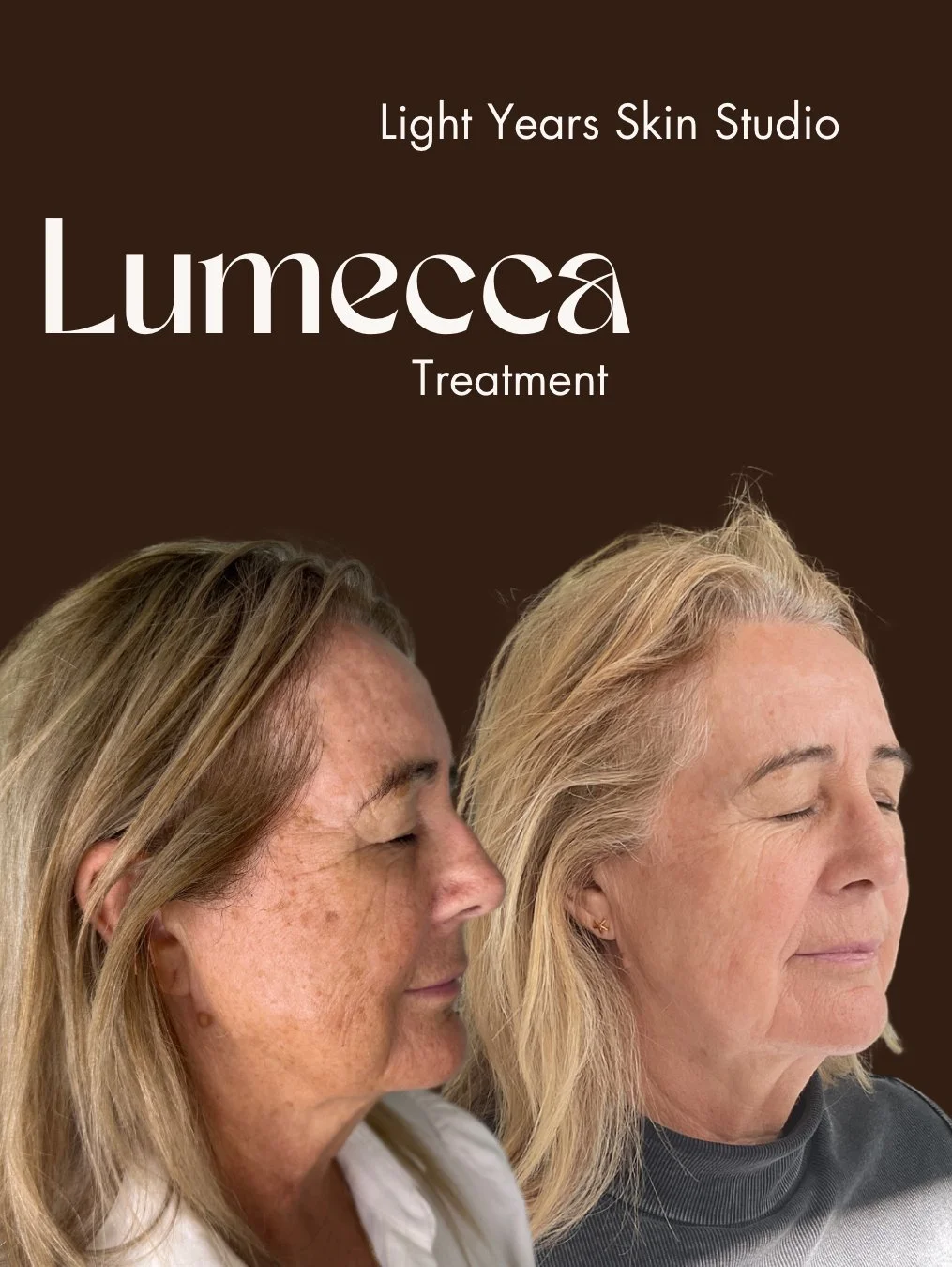 Lumecca - 33.jpeg