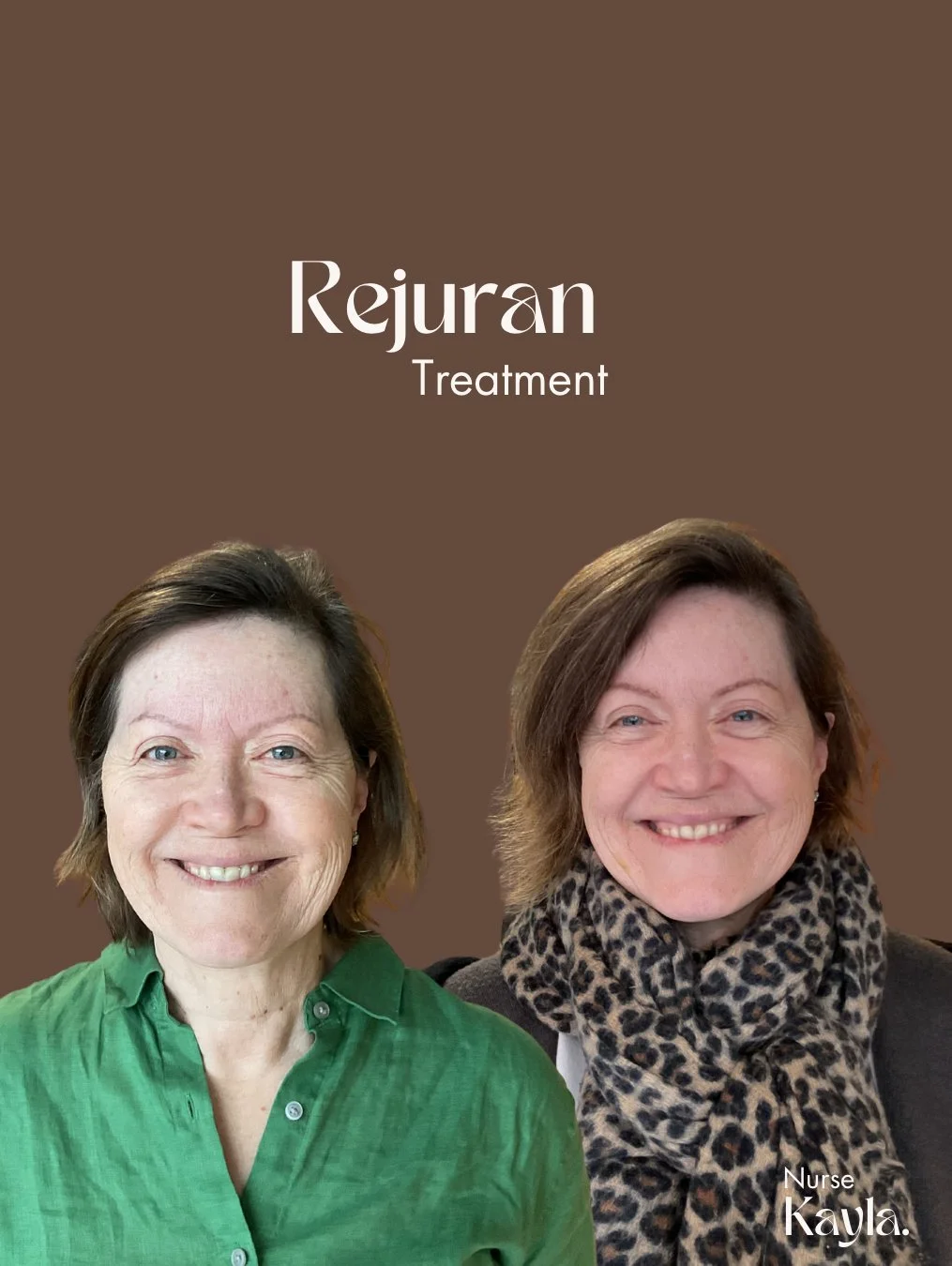 Rejuran (1015 x 1350 px) - 7.jpeg