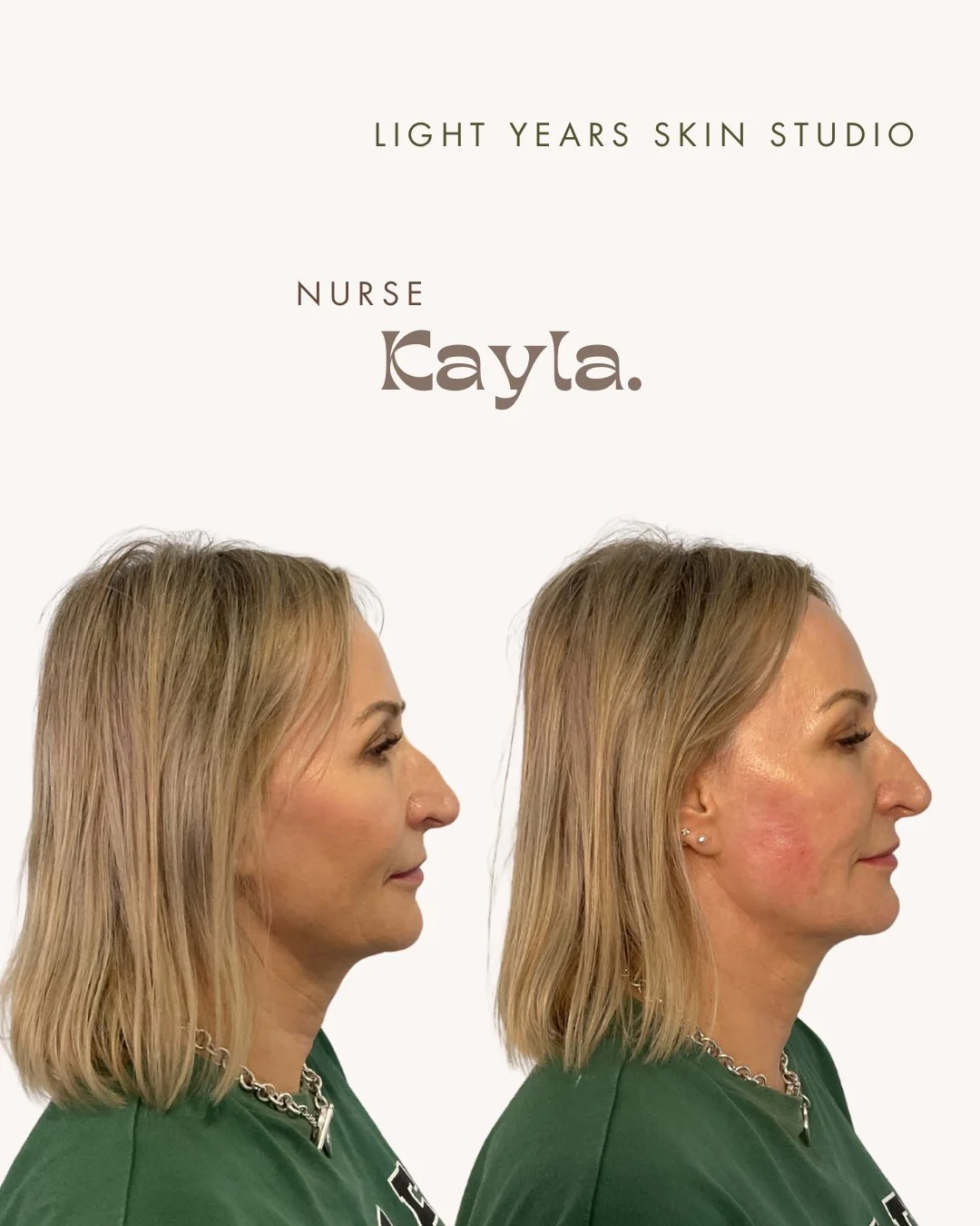 B&A LIPS_1.jpeg