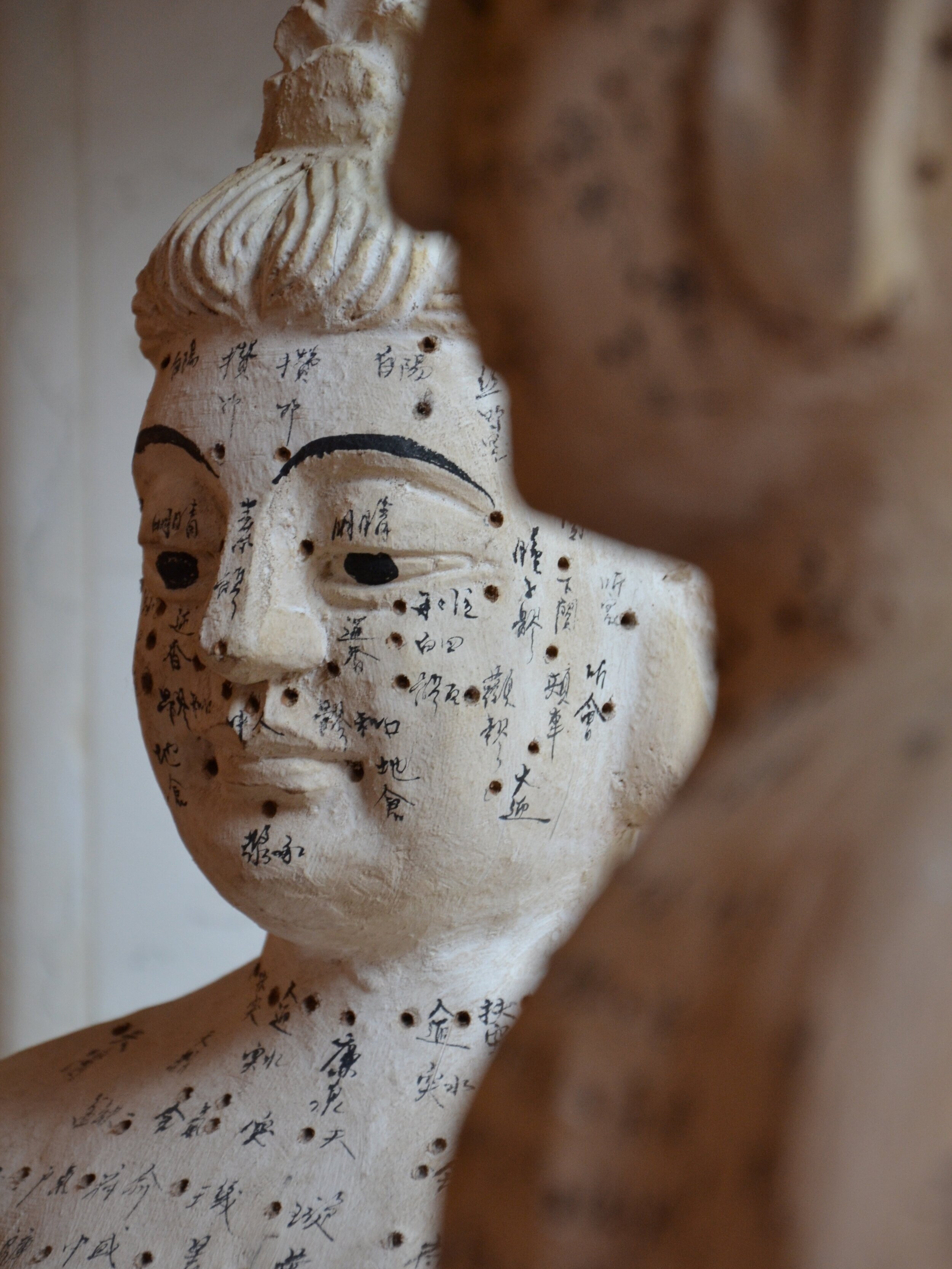 acupuncture-2956847.jpg