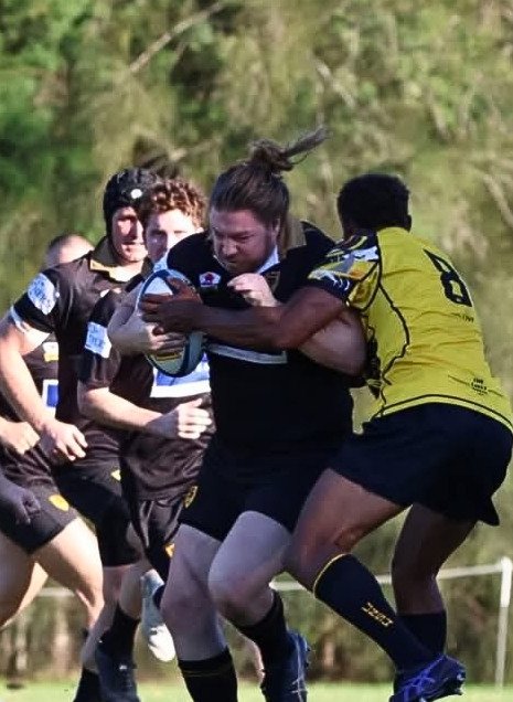 Shoulder Dislocations in Contact Sports: Assessment, Management &amp; When Surgery May Be the Better Option