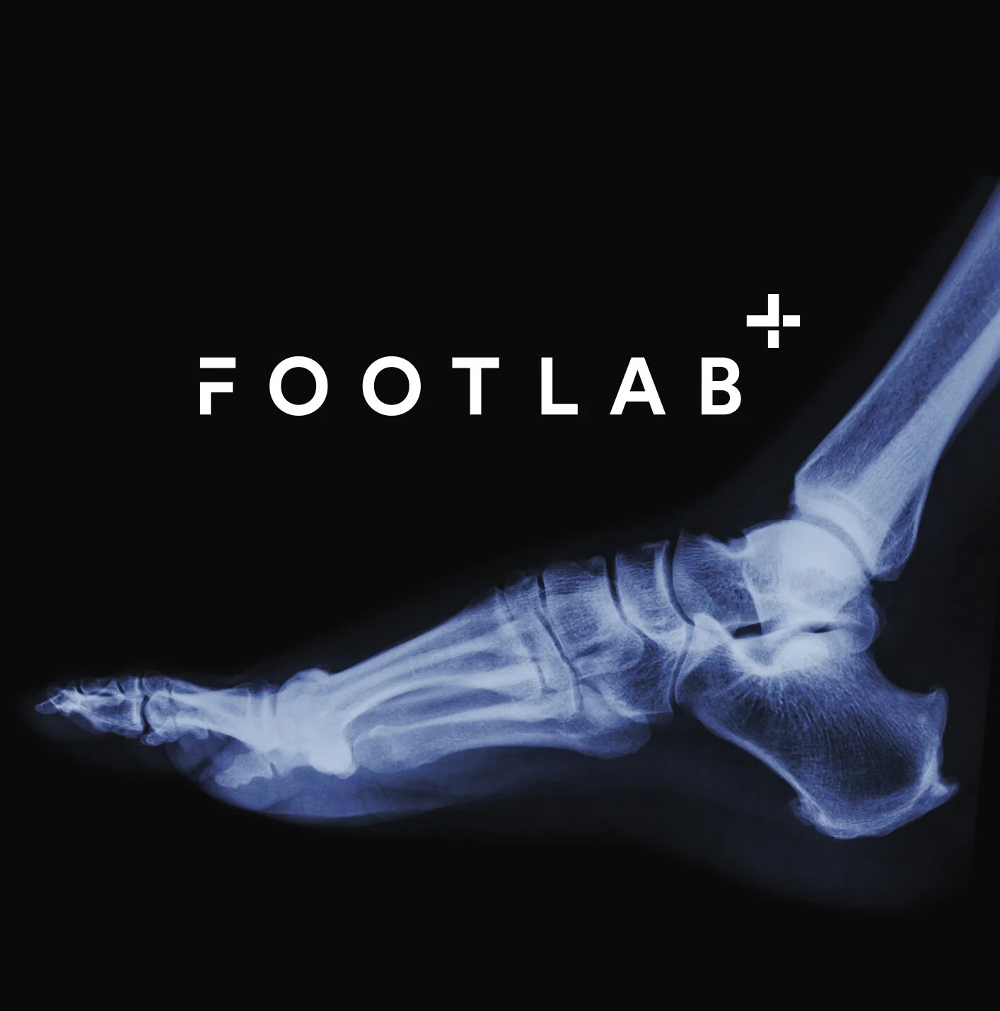 Footlab+ Podiatry Melbourne Harcourt Specialist Centre Kew