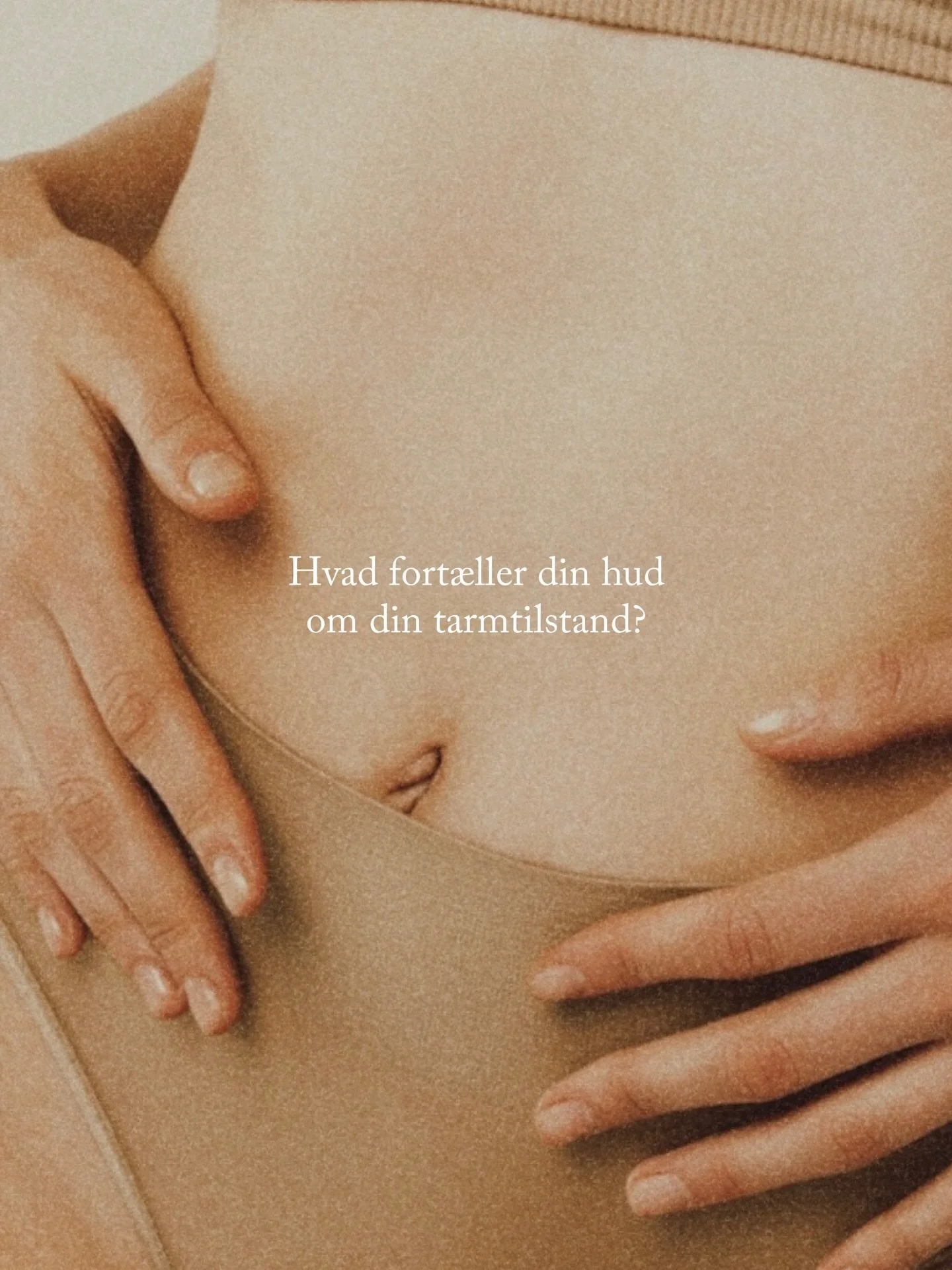 Hvad fort&aelig;ller din hud om din tarmtilstand?

For mange er huden et spejl p&aring;, hvordan din tarm og ford&oslash;jelse har det.
N&aring;r tarmen er i ubalance, kan det skabe inflammation i kroppen &ndash; og huden er ofte det sted, det bliver