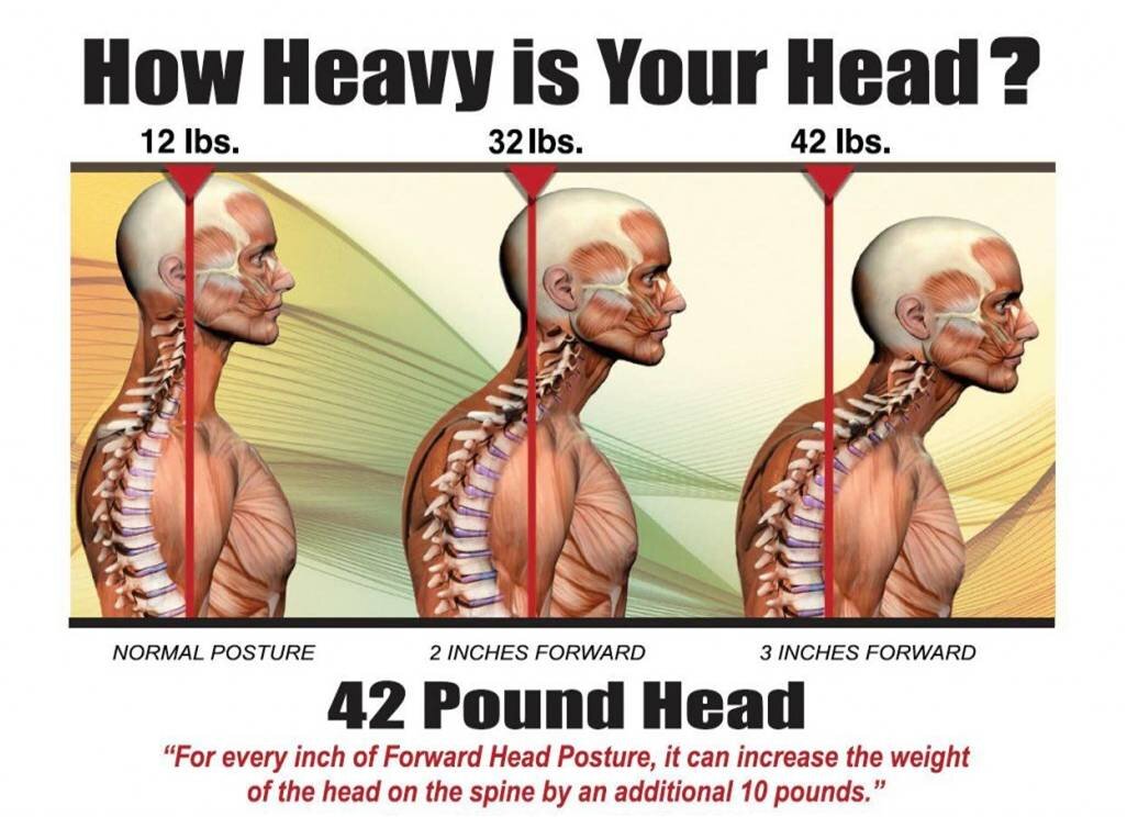 Understanding Forward Head Posture — Core Wellness Centres // Change Your  Life!