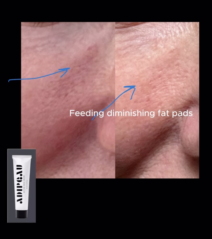 Screenshot 2026-01-13 at 09.38.09.png