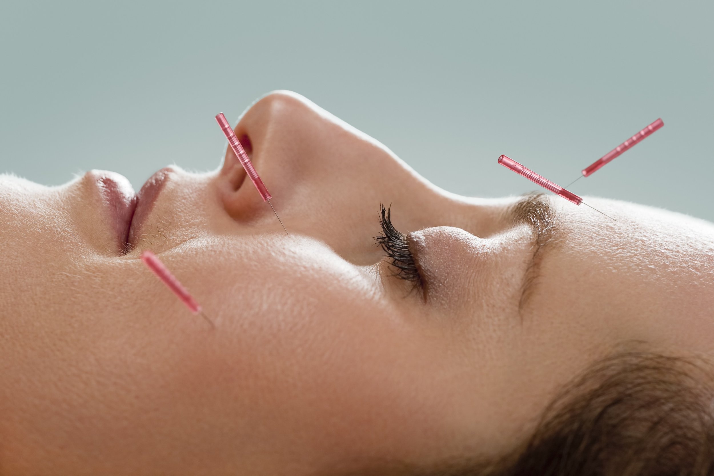 Cosmetic Acupuncture Single Treatment