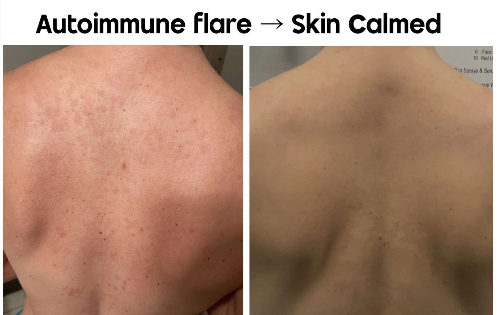 If You’re Doing Everything “Right” — And Your Skin Is Still Getting Worst — Stop.