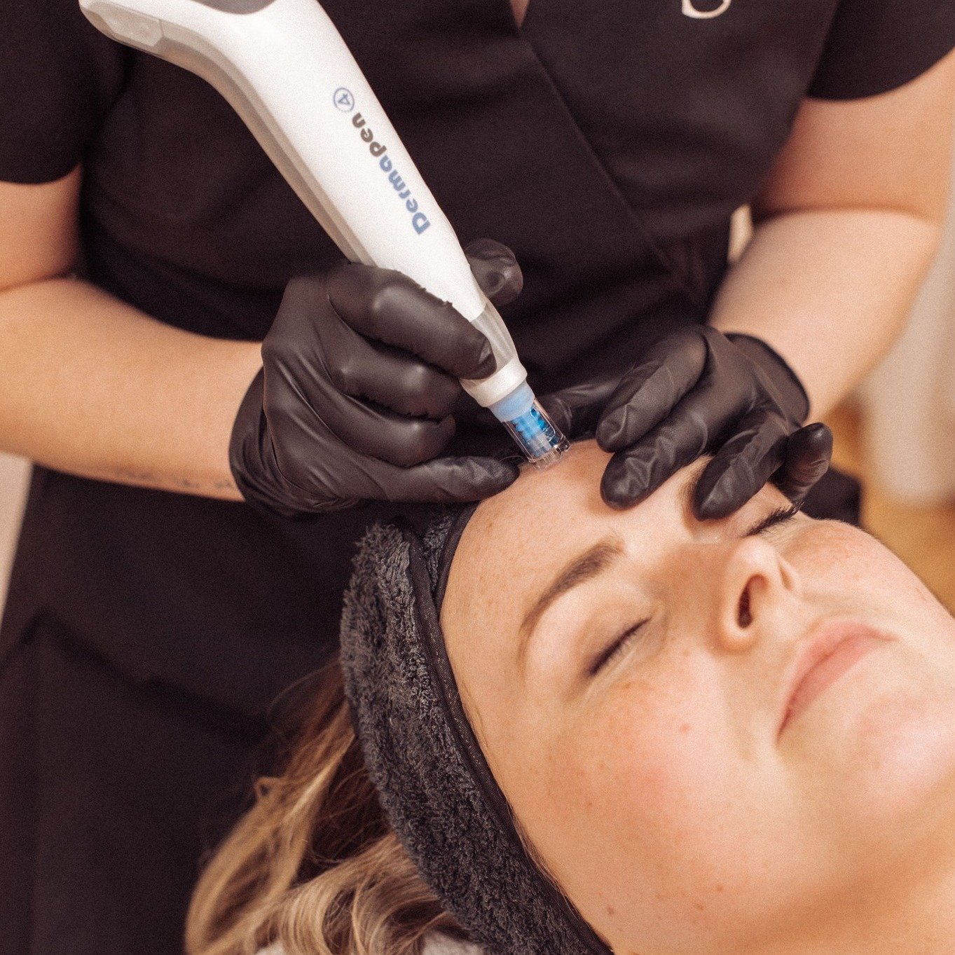 🌟 Transform Your Skin with Microneedling! 🌟 Introducing Dermapen4, your ultimate skincare solution for smoother, firmer skin. ✨ Whether you're battling acne scars, fine lines, or dullness, microneedling can help stimulate collagen production and re