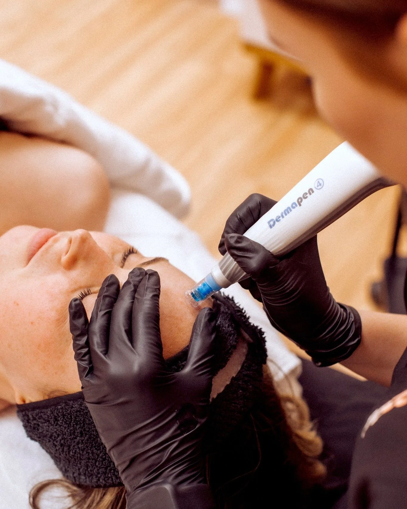 If you are looking to improve your skin but are not sure where to start, microneedling is one of the most effective treatments we offer.

Also known as collagen induction therapy, microneedling works by stimulating your skin&rsquo;s natural healing r