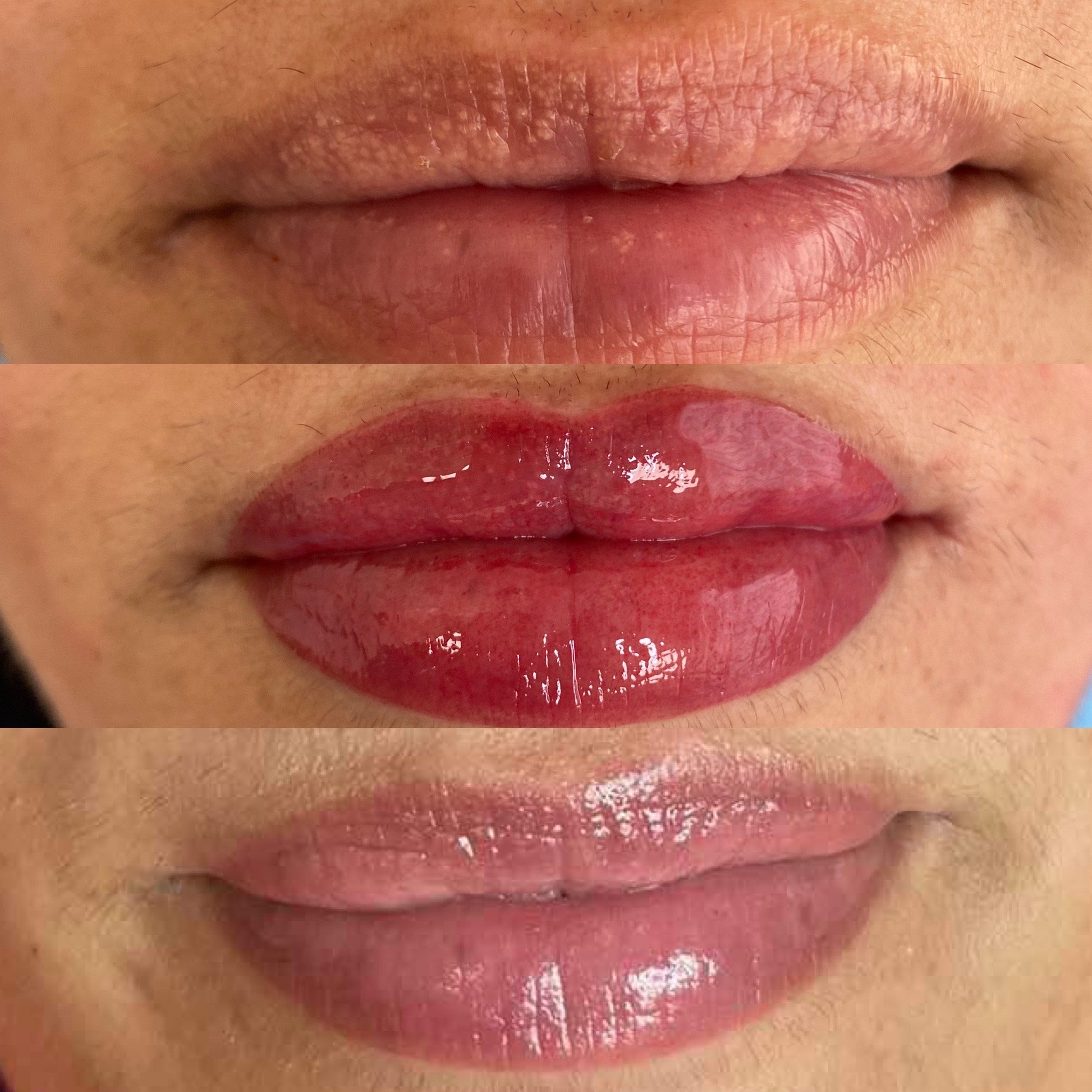 Lip Blush Tattooing done right can be the most beautiful, natural enhancement 👄✨

Perfect for adding soft definition, evening out tone and giving the lips a fresh healthy tint without looking overdone. Lip blush can also help neutralise and camoufla