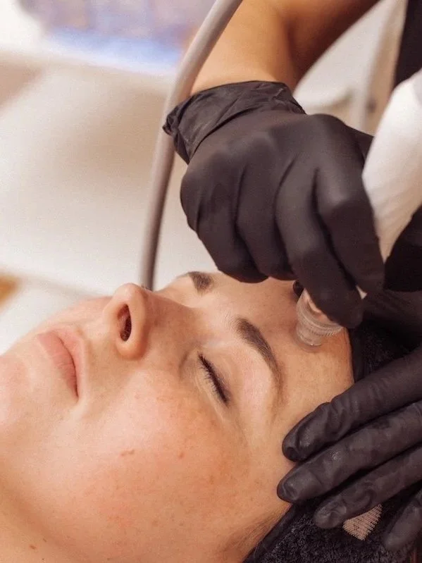 Hydrodermabrasion facial skin treatment