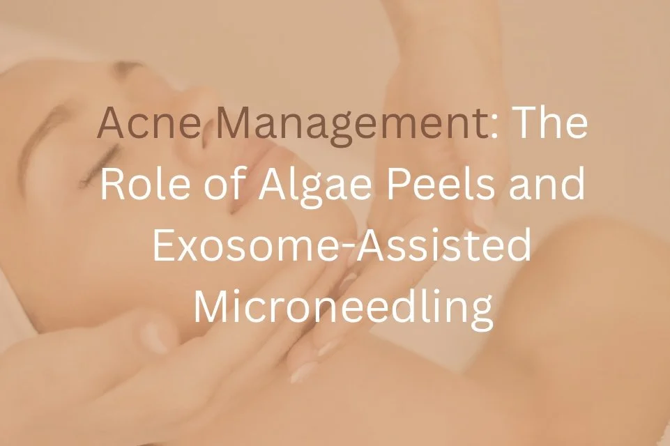 Acne Management: The Role of Algae Peels and Exosome-Assisted Microneedling
