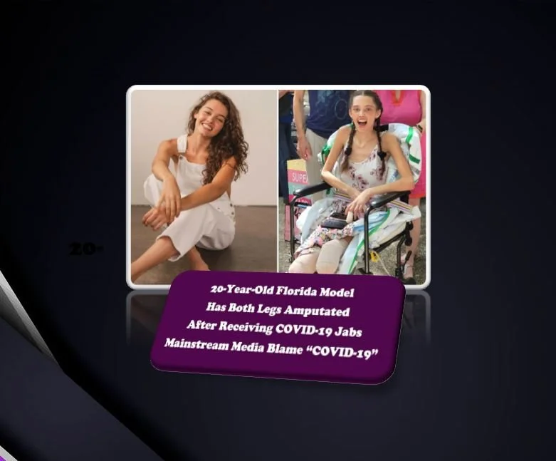 Claire Bridges: 20-Year-Old Florida Aspiring Model Has Both Legs Amputated After Receiving COVID-19 Jabs, Mainstream Media Blame “COVID-19”