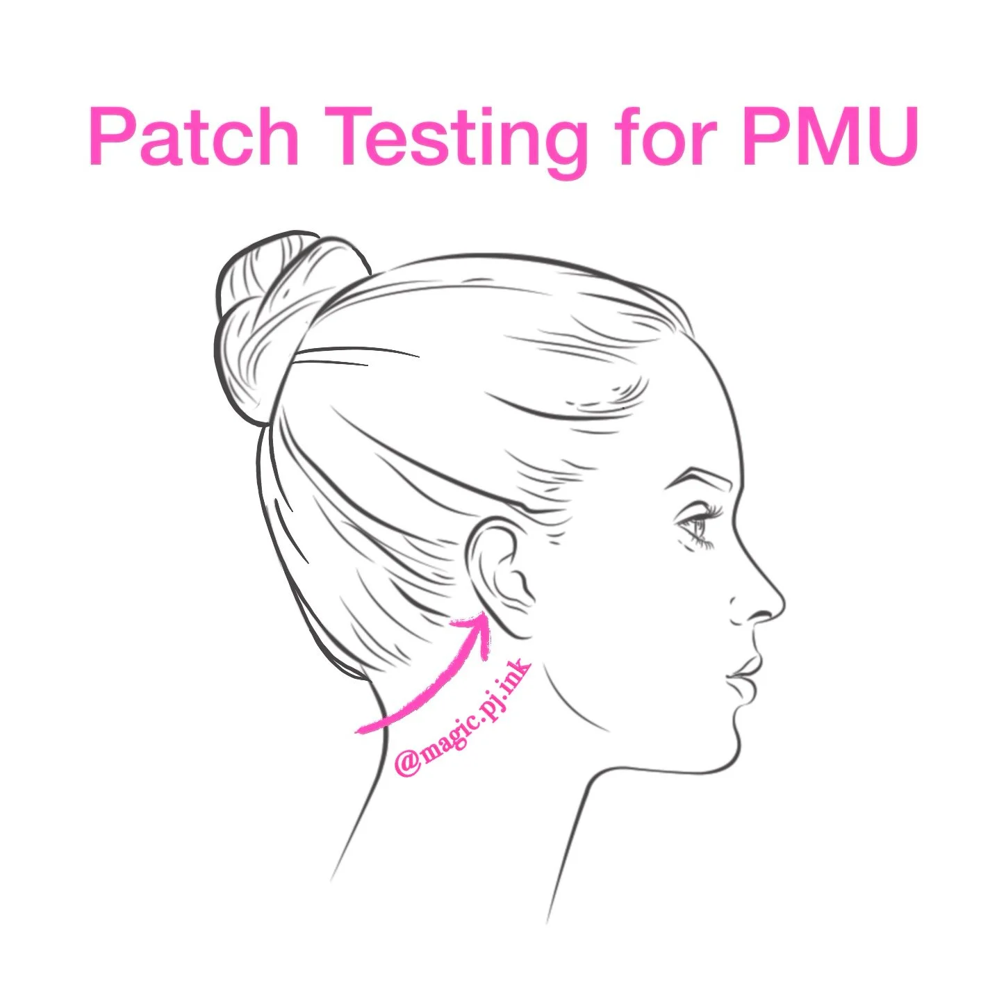 Sensitivity Concerns? Patch Testing PMU
